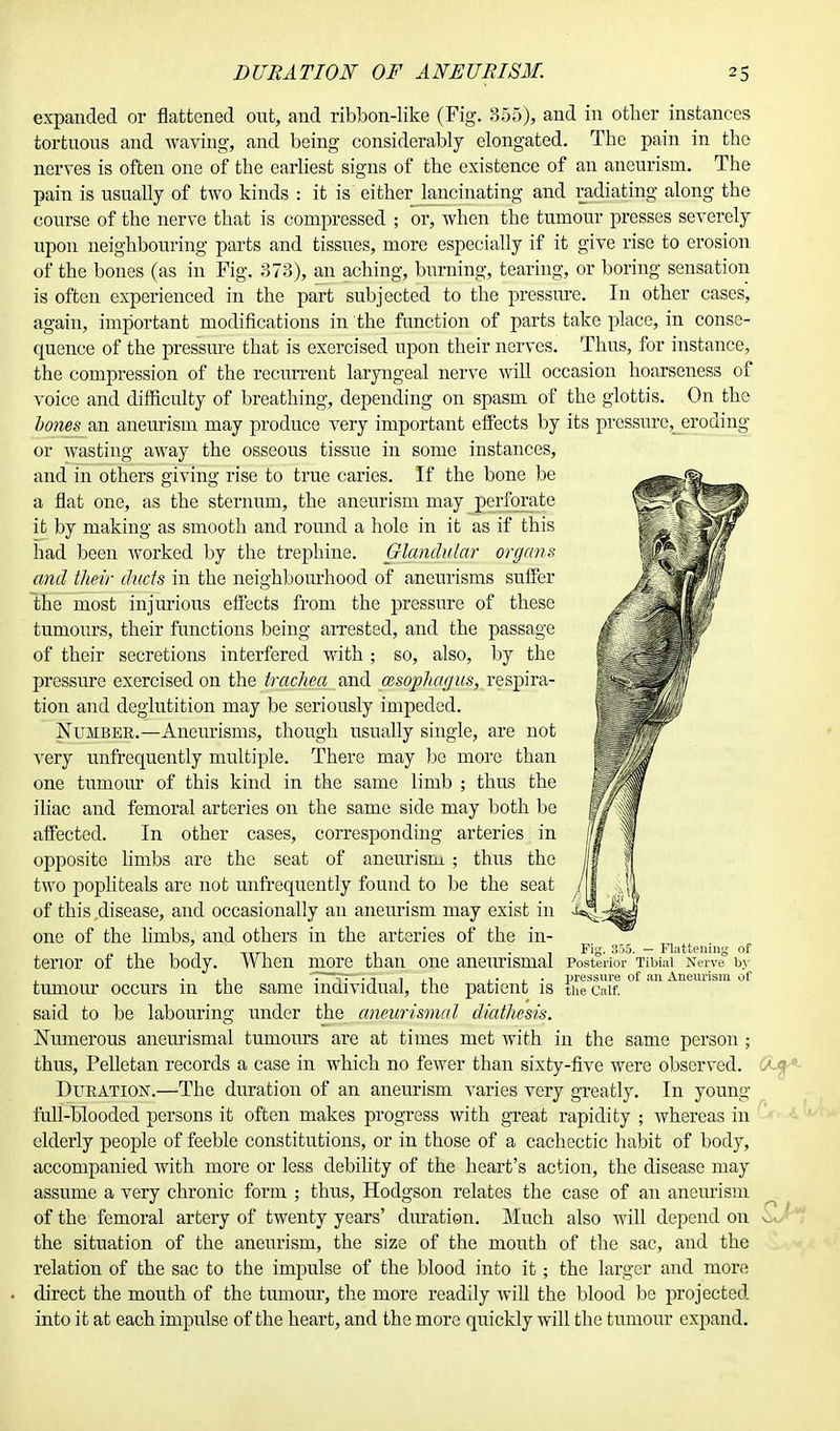 expanded or flattened out, and ribbon-like (Fig. 355), and in other instances tortuous and waving, and being considerably elongated. The pain in the nerves is often one of the earliest signs of the existence of an aneurism. The pain is usually of two kinds : it is either lancinating and radiating along the course of the nerve that is compressed ; or, when the tumour presses severely upon neighbouring parts and tissues, more especially if it give rise to erosion of the bones (as in Fig. 373), an aching, burning, tearing, or boring sensation is often experienced in the part subjected to the pressure. In other cases, again, important modifications in the function of parts take place, in conse- quence of the pressure that is exercised upon their nerves. Thus, for instance, the compression of the recurrent laryngeal nerve will occasion hoarseness of voice and difficulty of breathing, depending on spasm of the glottis. On the hones an aneurism may produce very important effects by its pressure, eroding or wasting away the osseous tissue in some instances, and in others giving rise to true caries. If the bone be a flat one, as the sternum, the aneurism may perforate it by making as smooth and round a hole in it as if this had been worked by the trephine. Glandular organs and their ducts in the neighbourhood of aneurisms suffer the most injurious effects from the pressure of these tumours, their functions being arrested, and the passage of their secretions interfered with ; so, also, by the pressure exercised on the trachea and (esophagus, respira- tion and deglutition may be seriously impeded. Number.—Aneurisms, though usually single, are not very unfrequently multiple. There may be more than one tumour of this kind in the same limb ; thus the iliac and femoral arteries on the same side may both be affected. In other cases, corresponding arteries in opposite limbs are the seat of aneurism ; thus the two popliteals are not unfrequently found to be the seat of this disease, and occasionally an aneurism may exist in one of the limbs, and others in the arteries of the in- „ , , ' Ttrl ,. . . Fig. 355. - Flattening of tenor of the body. When more than one aneurismal Posterior Tibial Nerve by ,, —i j_i l ■ pressure of an Aneurism of tumour occurs m the same individual, the patient is the Catf. said to be labouring under the aneurismal diathesis. Numerous aneurismal tumours are at times met with in the same person; thus, Pelletan records a case in which no fewer than sixty-five were observed. Duration.—The duration of an aneurism varies very greatly. In young full-blooded persons it often makes progress with great rapidity ; whereas in elderly people of feeble constitutions, or in those of a cachectic habit of body, accompanied with more or less debility of the heart's action, the disease may assume a very chronic form ; thus, Hodgson relates the case of an aneurism of the femoral artery of twenty years' duration. Much also will depend on the situation of the aneurism, the size of the mouth of the sac, and the relation of the sac to the impulse of the blood into it; the larger and more direct the mouth of the tumour, the more readily will the blood be projected into it at each impulse of the heart, and the more quickly will the tumour expand.