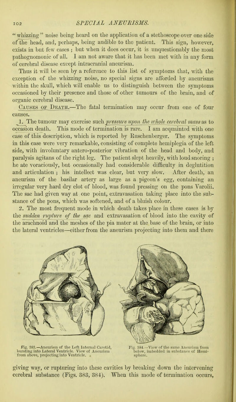  whizzing  noise being heard on the application of a stethoscope over one side of the head, and, perhaps, being audible to the patient. This sign, however, exists in but few cases ; but when it does occur, it is unquestionably the most pathognomonic of all. I am not aware that it has been met with in any form of cerebral disease except intracranial aneurism. Thus it will be seen by a reference to this list of symptoms that, with the exception of the whizzing noise, no special signs are afforded by aneurisms within the skull, which will enable us to distinguish between the symptoms occasioned by their presence and those of other tumours of the brain, and of organic cerebral disease. Causes of Death.—The fatal termination may occur from one of four causes. 1. The tumour may exercise such pressure upon the whole cerebral mass as to occasion death. This mode of termination is rare. I am acquainted with one case of this description, which is reported by Ruschenberger. The symptoms in this case were very remarkable, consisting of complete hemiplegia of the left side, with involuntary antero-posterior vibration of the head and body, and paralysis agitans of the right leg. The patient slept heavily, with loud snoring ; he ate voraciously, but occasionally had considerable difficulty in deglutition and articulation ; his intellect was clear, but very slow. After death, an aneurism of the basilar artery as large as a pigeon's egg, containing an irregular very hard dry clot of blood, was found pressing on the pons Varolii. The sac had given way at one point, extravasation taking place into the sub- stance of the pons, which was softened, and of a bluish colour. 2. The most frequent mode in which death takes place in these cases is by the sudden rupture of the sac and extravasation of blood into the cavity of the arachnoid and the meshes of the pia mater at the base of the brain, or into the lateral ventricles—either from the aneurism projecting into them and there giving way, or rupturing into these cavities by breaking down the intervening cerebral substance (Figs. 383, 384). When this mode of termination occurs,