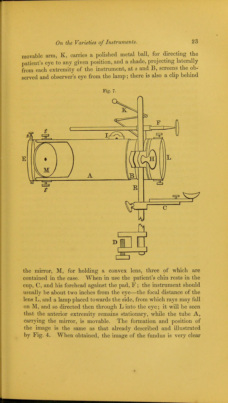 movable arm, K, carries a polished metal ball, for directing the patient's eye to any given position, and a shade, projecting laterally from each extremity of the instrument, at s and B, screens the ob- served and observer's eye from the lamp; there is also a clip behind Fig. 7. D 1 1 rf the mirror, M, for holding a convex lens, three of which are contained in the case. When in use the patient's chin rests in the cup, C, and his forehead against the pad, F; the instrument should usually be about two inches from the eye—the focal distance of the lens L, and a lamp placed towards the side, from which rays may fall on M, and so directed then through L into the eye; it will be seen that the anterior extremity remains stationary, while the tube A, carrying the mirror, is movable. The formation and position of the image is the same as that already described and illustrated by Fig. 4. When obtained, the image of the fundus is very clear