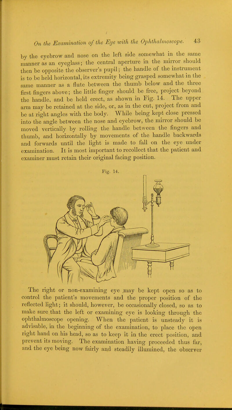 by the eyebrow and nose on the left side somewhat in the same manner as an eyeglass; the central aperture in the mirror should then be opposite the observer's pupil; the handle of the instrument is to be held liorizontal, its extremity being grasped somewhat in the same manner as a flute between the thumb below and the three first fingers above; the little finger should be free, project beyond the handle, and be held erect, as shown in Fig. 14.^ The upper arm may be retained at the side, or, as in the cut, project from and be at right angles with the body. While being kept close pressed into the angle between the nose and eyebrow, the mirror should be moved vertically by rolling the handle between the fingers and thumb, and horizontally by movements of the handle backwards and forwards until the light is made to fall on the eye under examination. It is most important to recollect that the patient and examiner must retain their original facing position. Fig. 14. The right or non-examining eye .may be kept open so as to control the patient's movements and the proper position of the reflected light; it should, however, be occasionally closed, so as to make sure that the left or examining eye is lookinsr throusfh the ophthalmoscope opening. When the patient is unsteady it is advisable, in the beginning of the examination, to place the open right hand on his head, so as to keep it in the erect position, and prevent its moving. The examination having proceeded thus far, and the eye being now fairly and steadily illumined, the observer