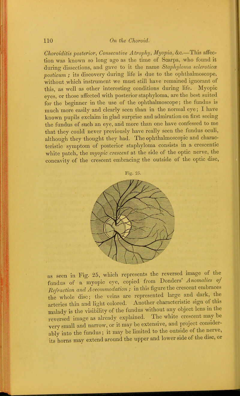 Choroiditis posterior, Consecutive Atrophy, Myopia, &c.—This affec- tion was known so long ago as the time of Scarpa, who found it during dissections, and gave to it the name Staphyloma scleroticoe posticum ; its discovery during life is due to the ophthalmoscope, without which instrument we must still have remained ignorant of this, as well as other interesting conditions during life. Myopic eyes, or those affected with posterior staphyloma, are the best suited for the beginner in the use of the ophthalmoscope; the fundus is much more easily and clearly seen than in the normal eye; I have known pupils exclaim in glad surprise and admiration on first seeing the fundus of such an eye, and more than one have confessed to me that they could never previously have really seen the fundus oculi, although they thought they had. The ophthalmoscopic and charac- teristic symptom of posterior staphyloma consists in a crescentic white patch, the myopic crescent at the side of the optic nerve, the concavity of the crescent embracing the outside of the optic disc, Fig. 25. as seen in Fig. 25, which represents the reversed image of the fundus of a myopic eye, copied from Bonders' Anomalies of Refraction and A ccommodation; in this figure the crescent embraces the whole disc; the veins are represented large and dark, the arteries thin and light colored. Another characteristic sign of this malady is the visibility of the fundus without any object lens in the reversed image as already explained. The white crescent may be very small and narrow, or it may be extensive, and project consider- ably into the fundus; it may be limited to the outside of the nerve, its horns mav extend around the upper and lower side of the disc, or