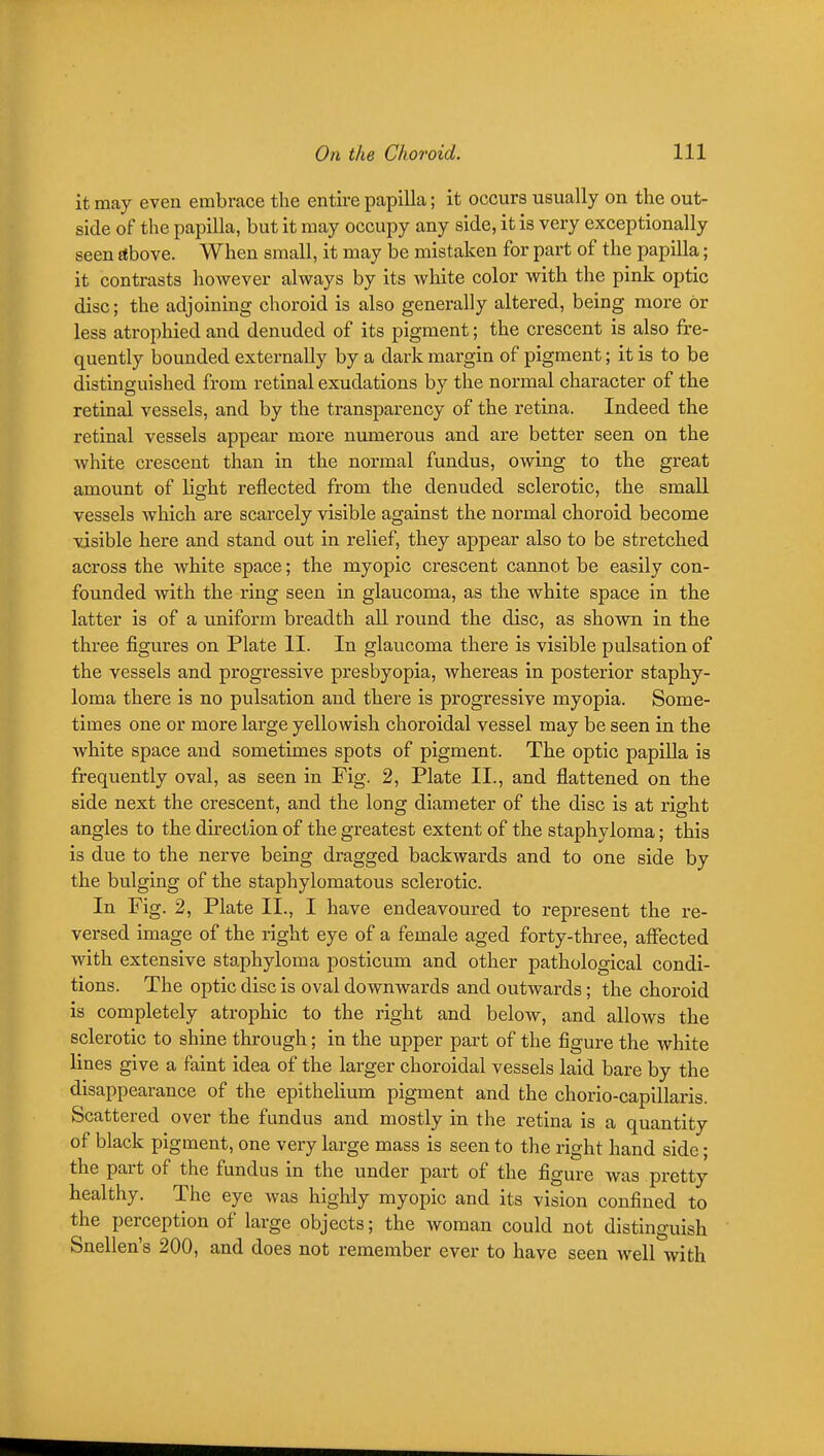 it may even embrace tlie entire papilla; it occurs usually on the out- side of the papilla, but it may occupy any side, it is very exceptionally seen above. When small, it may be mistaken for part of the papilla; it contrasts however always by its white color with the pink optic disc; the adjoining choroid is also generally altered, being more or less atrophied and denuded of its pigment; the crescent is also fre- quently bounded externally by a dark margin of pigment; it is to be distinguished from retinal exudations by the normal character of the retinal vessels, and by the transparency of the retina. Indeed the retinal vessels appear more nmnerous and are better seen on the white crescent than in the normal fundus, owing to the great amount of light reflected from the denuded sclerotic, the small vessels which are scarcely visible against the normal choroid become visible here and stand out in relief, they appear also to be stretched across the white space; the myopic crescent cannot be easily con- founded with the ring seen in glaucoma, as the white space in the latter is of a uniform breadth all round the disc, as shown in the three figures on Plate II. In glaucoma there is visible pulsation of the vessels and progressive presbyopia, whereas in posterior staphy- loma there is no pulsation and there is progressive myopia. Some- times one or more large yellowish choroidal vessel may be seen in the Avhite space and sometimes spots of pigment. The optic papilla is frequently oval, as seen in Fig. 2, Plate II., and flattened on the side next the crescent, and the long diameter of the disc is at right angles to the direction of the greatest extent of the staphyloma; this is due to the nerve being dragged backwards and to one side by the bulging of the staphylomatous sclerotic. In Fig. 2, Plate II., I have endeavoured to represent the re- versed image of the right eye of a female aged forty-three, affected with extensive staphyloma posticum and other pathological condi- tions. The optic disc is oval downwards and outwards; the choroid is completely atrophic to the right and below, and allows the sclerotic to shine through; in the upper part of the figure the white lines give a faint idea of the larger choroidal vessels laid bare by the disappearance of the epithelium pigment and the chorio-capillaris. Scattered over the fundus and mostly in the retina is a quantity of black pigment, one very large mass is seen to the right hand side; the part of the fundus in the under part of the figure was pretty healthy. The eye was highly myopic and its vision confined to the perception of large objects; the woman could not distinguish Snellen's 200, and does not remember ever to have seen well with