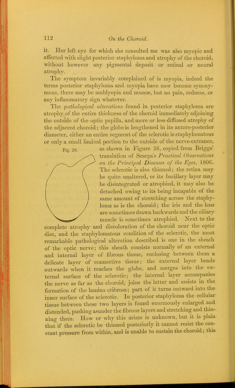 it. Her left eye for Avhich ishe consulted me was also myopic and affected with slight posterior staphyloma and atrophy of the choroid, without however any pigmental deposit or retinal or neural atrophy. The symptom invariably complained of is myopia, indeed the terms posterior staphyloma and myopia have now become synony- mous, there may be amblyopia and muscae, but no pain, redness, or any inflammatory sign whatever. The pathological alterations found in posterior staphyloma are atrophy of the entire thickness of the choroid immediately adjoining the outside of the optic papilla, and more or less diffused atrophy of the adjacent choroid; the globe is lengthened in its antero-posterior diameter, either an entire segment of the sclerotic is staphylomatous or only a small limited portion to the outside of the nerve-entrance, Fig. 26. as shown in Figure 26, copied from Briggs' translation of Scarpa's Practical Observations on the Principal Diseases of the Eyes, 1806. The sclerotic is also thinned; the retina may be quite unaltered, or its bacillary layer may be disintegrated or atrophied, it may also be detached owing to its being Incapable of the same amount of stretching across the staphy- loma as is the choroid; the iris and the lens are sometimes drawn backwards and the ciliary muscle is sometimes atrophied. Next to the complete atrophy and discoloration of the choroid near the optic disc, and the staphylomatous condition of the sclerotic, the most remarkable pathological alteration described is one in the sheath of the optic nerve; this sheath consists normally of an external and internal layer of fibrous tissue, enclosing between them a delicate layer of connective tissue; the external layer bends outwards when it reaches the globe, and merges into the ex- ternal surface of the sclerotic; the internal layer accompanies the nerve as far as the choroid, joins the latter and assists in the formation of the lamina cribrosa; part of it turns outward into the inner surface of the sclerotic. In posterior staphyloma the cellular tissue between these two layers is found enormously enlarged and distended, pushing asunder the fibrous layers and stretching and thin- nino- them. How or why this arises is unknown, but it is plain that if the sclerotic be thinned posteriorly it cannot resist the con- stant pressure from within, and is unable to sustain the choroid; this