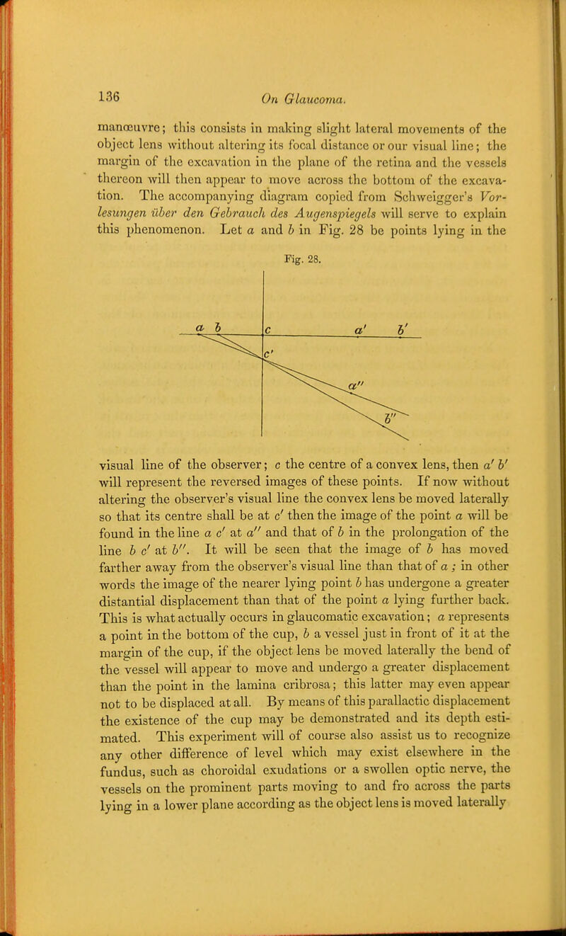 manoeuvre; this consists in making slight lateral movements of the object lens without altering its focal distance or our visual line; the margin of the excavation in the plane of the retina and the vessels thereon will then appear to move across the bottom of the excava- tion. The accompanying diagram copied from Schweigger's Vor- lesimgen iiber den Gebrauch des Augenspiegels Avill serve to explain this phenomenon. Let a and h in Fig. 28 be points lying in the Fig. 28. a h c a' y C visual line of the observer; c the centre of a convex lens, then a' h' will represent the reversed images of these points. If now without altering the observer's visual line the convex lens be moved laterally so that its centre shall be at c' then the image of the point a will be found in the line a c' at a and that of h in the prolongation of the line h c' at h. It will be seen that the image of h has moved farther away from the observer's visual line than that of a ; in other words the image of the nearer lying point h has undergone a greater distantial displacement than that of the point a lying further back. This is what actually occurs in glaucomatic excavation; a represents a point in the bottom of the cup, h a vessel just in front of it at the margin of the cup, if the object lens be moved laterally the bend of the vessel will appear to move and undergo a greater displacement than the point in the lamina cribrosa; this latter may even appear not to be displaced at all. By means of this parallactic displacement the existence of the cup may be demonstrated and its depth esti- mated. This experiment will of course also assist us to recognize any other difference of level which may exist elsewhere in the fundus, such as choroidal exudations or a swollen optic nerve, the vessels on the prominent parts moving to and fro across the parts lying in a lower plane according as the object lens is moved laterally