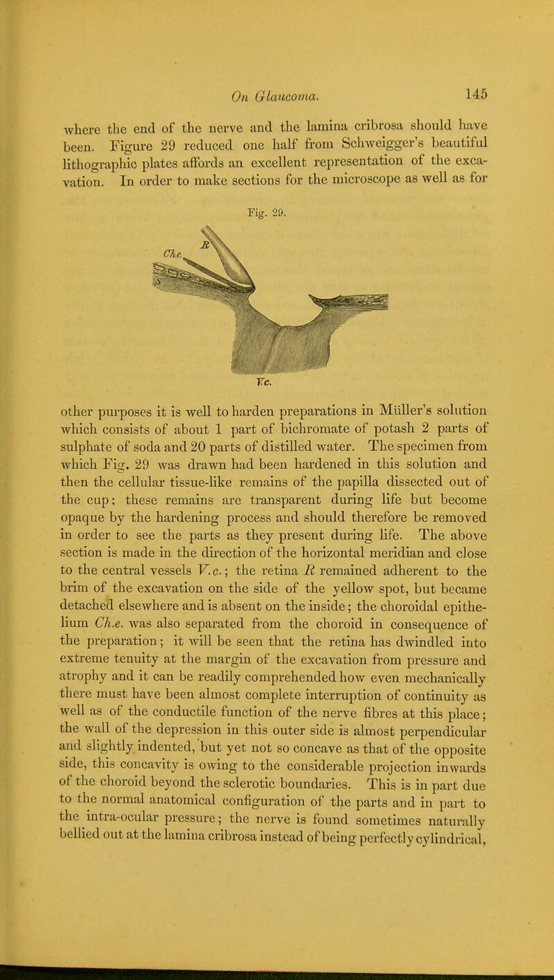 where the end of the nerve and the lamina cribrosa should have been. Figure 29 reduced one half from Schweigger's beautiful lithographic plates affords an excellent representation of the exca- vation. In order to make sections for the microscope as well as for Fig. 29. Vc. Other purposes it is well to harden preparations in Miiller's solution which consists of about 1 part of bichromate of potash 2 parts of sulphate of soda and 20 parts of distilled water. The specimen from which Fig. 29 was drawn had been hardened in this solution and then the cellular tissue-like remains of the papilla dissected out of the cup; these remains are transparent during life but become opaque by the hardening process and should therefore be removed in order to see the parts as they present during life. The above section is made in the dkection of the horizontal meridian and close to the central vessels V. c.; the retina R remained adherent to the brim of the excavation on the side of the yellow spot, but became detached elsewhere and is absent on the inside; the choroidal epithe- lium Ch.e. was also separated from the choroid in consequence of the preparation; it will be seen that the retina has dwindled into extreme tenuity at the margin of the excavation from pressure and atrophy and it can be readily comprehended hoAv even mechanically there must have been almost complete interruption of continuity as well as of the conductile function of the nerve fibres at this place; the wall of the depression in this outer side is almost perpendicular and slightly indented, but yet not so concave as that of the opposite side, this concavity is owing to the considerable projection inwards of the choroid beyond the sclerotic boundaries. This is in part due to the normal anatomical configuration of the parts and in part to the intra-ocular pressure; the nerve is found sometimes naturally bellied out at the lamina cribrosa instead of being perfectly cylindrical,