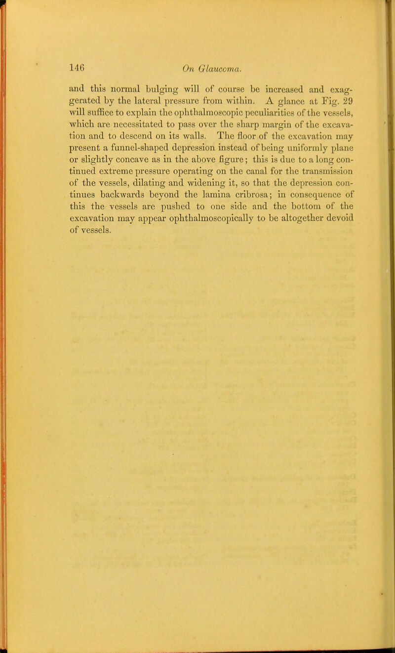 and this normal bulging will of coiirse be increased and exag- gerated by the lateral pressure from within. A glance at Fig. 29 will suffice to explain the ophthalmoscopic peculiarities of the vessels, which are necessitated to pass over the sharp margin of the excava- tion and to descend on its walls. The floor of the excavation may present a funnel-shaped depression instead of being uniformly plane or slightly concave as in the above figure; this is due to a long con- tinued extreme pressure operating on the canal for the transmission of the vessels, dilating and widening it, so that the depression con- tinues backwards beyond the lamina cribrosa; in consequence of this the vessels are pushed to one side and the bottom of the excavation may appear ophthalmoscopically to be altogether devoid of vessels.