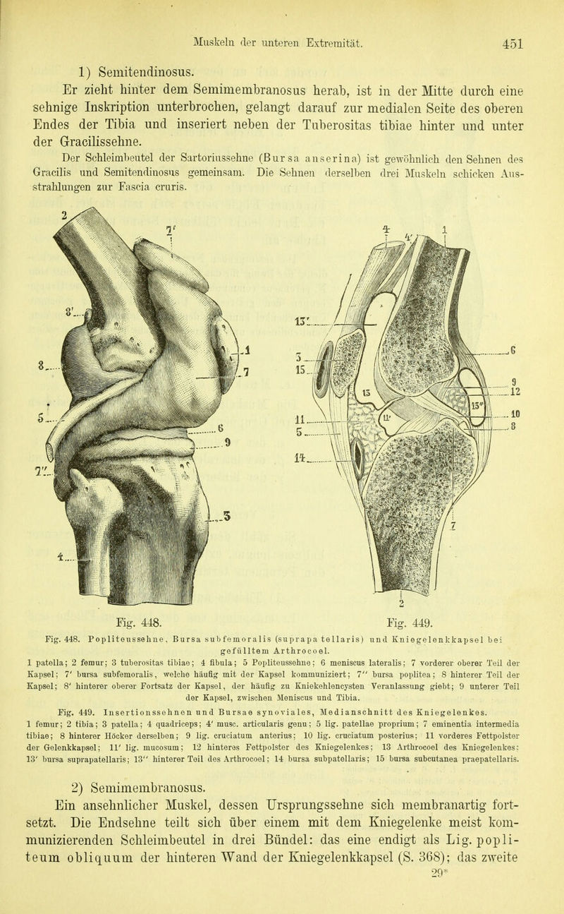 1) Semitendinosus. Er zieht hinter dem Semimembranosus herab, ist in der Mitte durch eine sehnige Inskription unterbrochen, gelangt darauf zur medialen Seite des oberen Endes der Tibia und inseriert neben der Tuberositas tibiae hinter und unter der Gracilissehne. Der Schleimbeutel der Sartoriussehne (Bursa anserina) ist gewöhnlich den Sehnen des Gracilis und Semitendinosus gemeinsam. Die Sehnen derselben drei Muskeln schicken Aus- strahlungen zur Fascia cruris. Fig. 448. Fig. 449. Fig. 448. Popliteussehne, Bursa sub femoralis (suprapa tellaris) und Kniegelenkkapsel bei gefülltem Arthrocoel. 1 patella; 2 femur; 3 tuberositas tibiae; 4 fibula; 5 Popliteussehne; 6 meniscus lateralis; 7 vorderer oberer Teil der Kapsel; 7' bursa subfemoralis, welche häufig mit der Kapsel kommuniziert; 1 bursa poplitea; 8 hinterer Teil der Kapsel; 8' hinterer oberer Fortsatz der Kapsel, der häufig zu Kniekehlencysten Veranlassung giebt; 9 unterer Teil der Kapsel, zwischen Meniscus und Tibia. Fig. 449. lusertionssehnen und Bursae synoviales, Medianschnitt des Kniegelenkes. 1 femur; 2 tibia; 3 patella; 4 quadriceps; 4' musc. articularis genu; 5 lig. patellae proprium; 7 eminentia intermedia tibiae; 8 hinterer Höcker derselben; 9 lig. cruciatum anterius; 10 lig. cruciatum posterius; 11 vorderes Fettpolster der Gelenkkapsel; 11' lig. mueosum; 12 hinteras Fettpolster des Kniegelenkes; 13 Arthrocoel des Kniegelenkes: 13' bursa suprapatellaris; 13 hinterer Teil des Arthrocoel; 14 bursa subpatellaris; 15 bursa subcutanea praepatellaris. 2) Semimembranosus. Ein ansehnlicher Muskel^ dessen Ursprungssehne sich membranartig fort- setzt. Die Endsehne teilt sich über einem mit dem Kniegelenke meist kom- munizierenden Schleimbeutel in drei Bündel: das eine endigt als Lig. popli- teum obliquum der hinteren Wand der Kniegelenkkapsel (S. 368); das zweite 29*