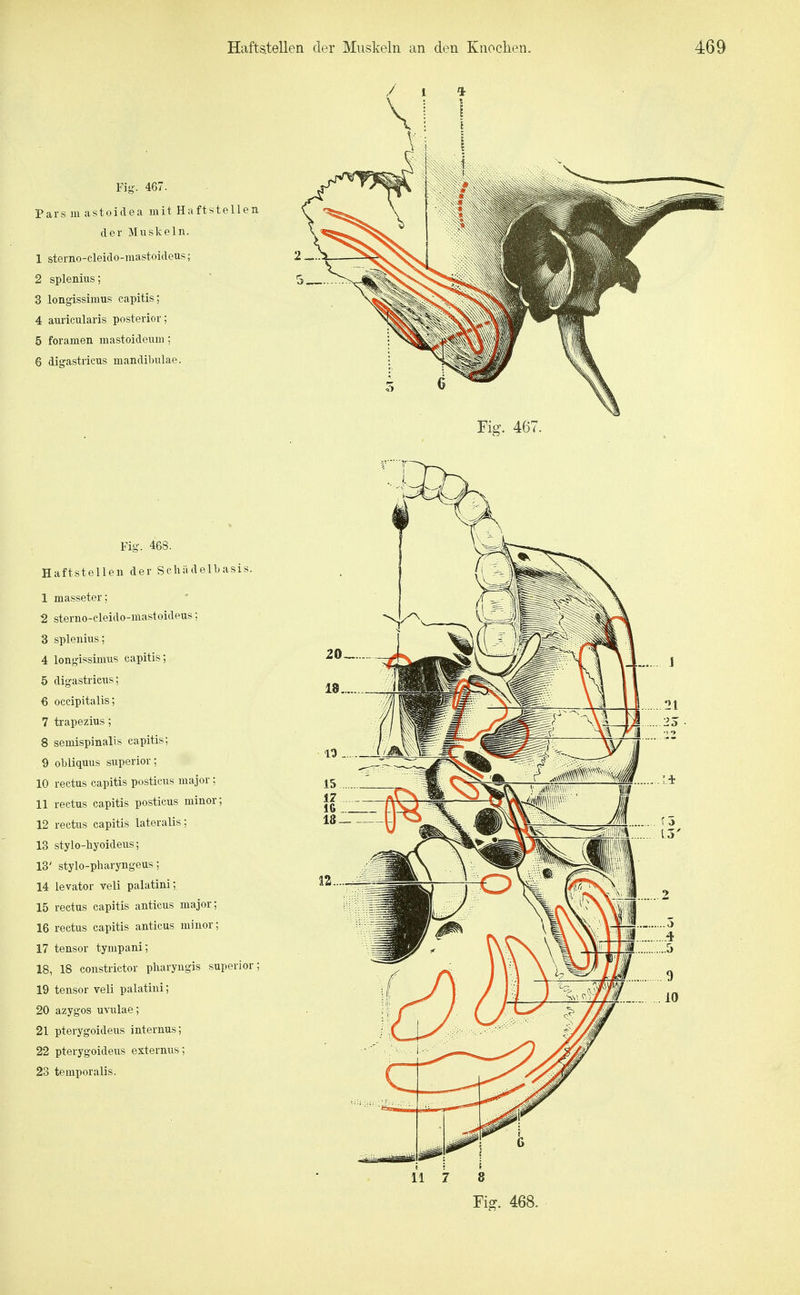 Fig-. 467. Pars m astoidea mit Haftstellen der Muskeln. 1 sterno-cleido-mastoideus; 2 2 splenius; ' 3 longissimus capitis; 4 auricularis posterior; 5 foramen mastoideuiii; 6 digastricus mandibulae. Fig. 467. Fig. 468. aftstellen der Schädelbasis. sterno-cleido-mastoideus; splenius; longissimus capitis; digastricus; occipitalis; trapezius; semispinalis capitis; obliquus superior; rectus capitis posticus major; rectus capitis posticus minor; rectus capitis lateralis; stylo-hyoideus; ' stylo-pharyngeus; levator veli palatini; rectus capitis anticus major; rectus capitis anticus minor; tensor tympani; , 18 constrictor pharyngis superior tensor veli palatini; azygos uYulae; pterygoideus internus; pterygoideus externus; temporalis.