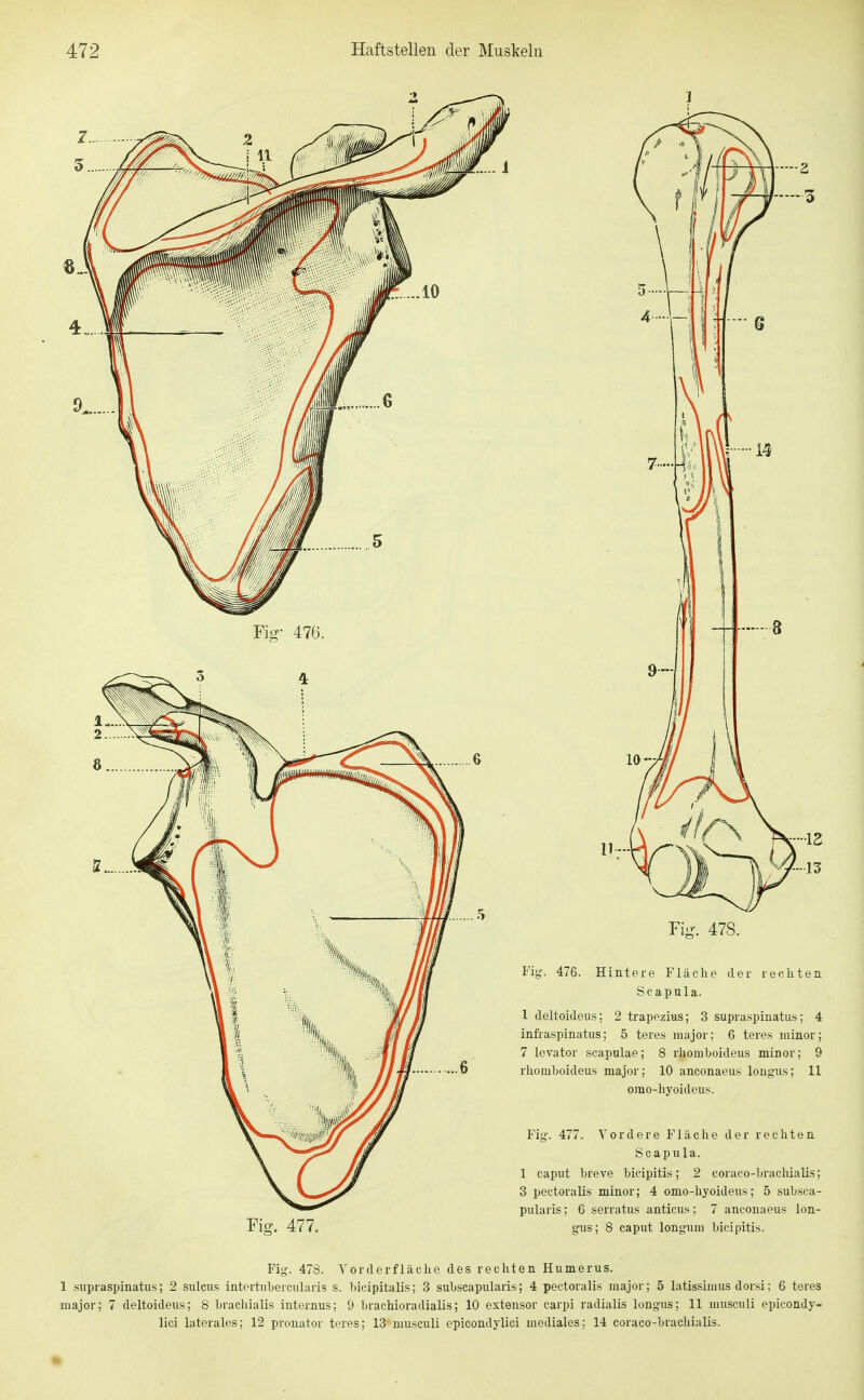 - Q 9- Eiff. 477. Fig. 478. Fig-. 476. Hintere Fläche der rechten Scapula. 1 deltoideus; 2 trapezius; 3 supraspinatus; 4 infraspinatus; 5 teres major; 6 teres minor; 7 levator scapulae; 8 rhomboideus minor; 9 rhomboideus major; 10 anconaeus longus; 11 orao-hyoideus. Fiy. 477. Vordere Fläche der rechten Scapula. 1 Caput breve bicipitis; 2 coraco-brachialis; 3 pectoralis minor; 4 omo-hyoideus; 5 subsca- pularis; 6 serratus anticus; 7 anconaeus lon- g-us; 8 Caput long-um bicipitis. Fig. 478. Yorderfläche des rechten Humerus. 1 supraspinatus; 2 sulcus intertubercularis s. bicipitalis; 3 subscapularis; 4 pectoralis major; 5 latissimus dorsi; 6 teres major; 7 deltoideus; 8 brachialis internus; 9 brachioradialis; 10 exteusor carpi radialis longus; 11 musculi epicondy- lici laterales; 12 pronator teres; 13 musculi epicondylici mediales: 14 coraco-brachialis.