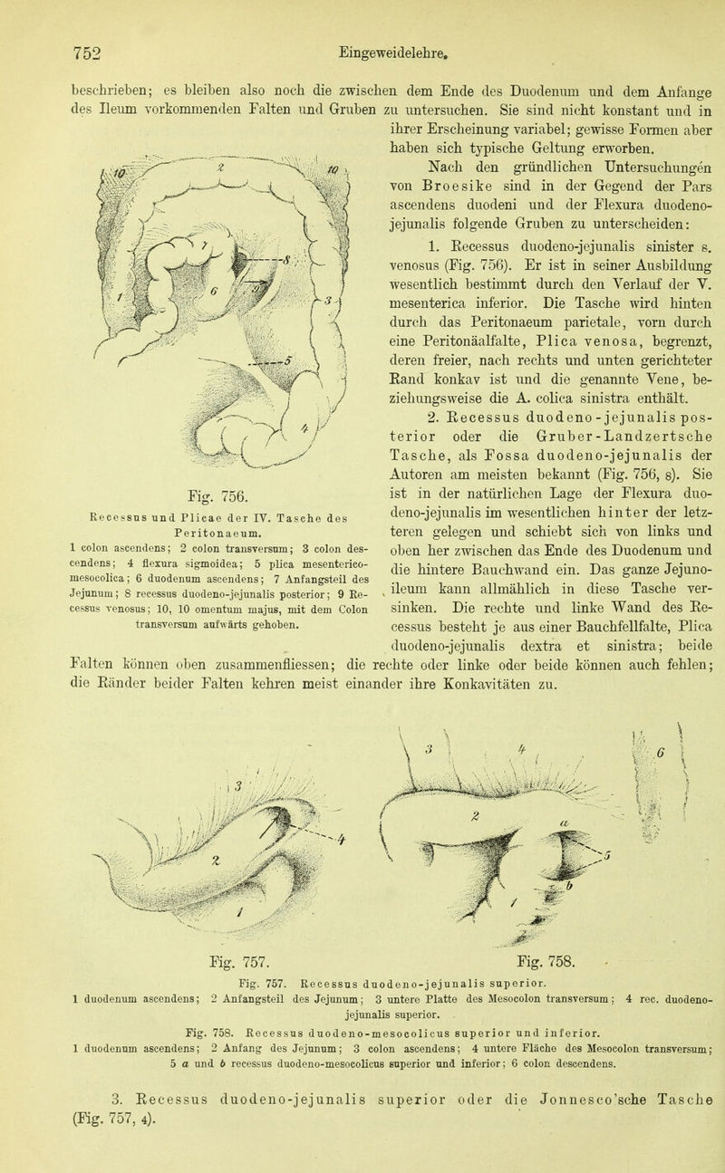 beschrieben; es bleiben also noch die zwischen dem Ende des Duodenum und dem Anfange des Ileum vorkommenden Falten und Gruben zu untersuchen. Sie sind nicht konstant und in ihrer Erscheinung variabel; gewisse Formen aber haben sich typische Geltung erworben. Nach den gründlichen Untersuchungen von Broesike sind in der Gegend der Pars ascendens duodeni und der Flexura duodeno- jejunalis folgende Gruben zu unterscheiden: 1. Eecessus duodeno-jejunalis sinister s. venosus (Fig. 756). Er ist in seiner Ausbildung wesentlich bestimmt durch den Verlauf der V. mesenterica inferior. Die Tasche wird hinten durch das Peritonaeum parietale, vorn durch eine Peritonäalfalte, Plica venosa, begrenzt, deren freier, nach rechts und unten gerichteter Eand konkav ist und die genannte Vene, be- ziehungsweise die A. colica sinistra enthält. 2. Eecessus duodeno-jejunalis pos- terior oder die Gruber-Landzertsche Tasche, als Fossa duodeno-jejunalis der Autoren am meisten bekannt (Fig. 756, s). Sie ist in der natürlichen Lage der Flexura duo- deno-jejunalis im wesentlichen hinter der letz- teren gelegen und schiebt sich von links und oben her zwischen das Ende des Duodenum und die hintere Bauchwand ein. Das ganze Jejuno- ileum kann allmählich in diese Tasche ver- sinken. Die rechte und linke Wand des Ee- cessus besteht je aus einer Bauchfellfalte, Plica duodeno-jejunalis dextra et sinistra; beide Falten können oben zusammenfliessen; die rechte oder linke oder beide können auch fehlen; die Eänder beider Falten kehren meist einander ihre Konkavitäten zu. Fig. 756. Recessus und Plicae der IV. Tasche des Peritonaeum. 1 Colon ascendens; 2 colon transversum; 3 colon des- cendens; 4 flexura sigmoidea; 5 plica mesenterico- mesocolica; 6 duodenum ascendens; 7 Anfangsteil des Jejunum; 8 recessus duodeno-jejunalis posterior; 9 Ee- cessus venosus; 10, 10 Omentum majus, mit dem Colon transversum aufwärts gehoben. Fig. 757. Fig. 758. - Fig. 757. Recessus duodeno-jejunalis superior. 1 duodenum ascendens; 2 Anfangsteil des Jejunum; 3 untere Platte des Mesocolon transversum; 4 rec. duodeno- jejunalis superior. Fig. 758. Recessus duodeno-mesocolicus superior und inferior. 1 duodenum ascendens; 2 Anfang des Jejunum; 3 colon ascendens; 4 untere Fläche des Mesocolon transversum; 5 a und 6 recessus duodeno-mesocolicus superior und inferior; 6 colon descendens. 3. Eecessus duodeno-jejunalis superior oder die Jonnesco'sche Tasche (Fig. 757, 4).