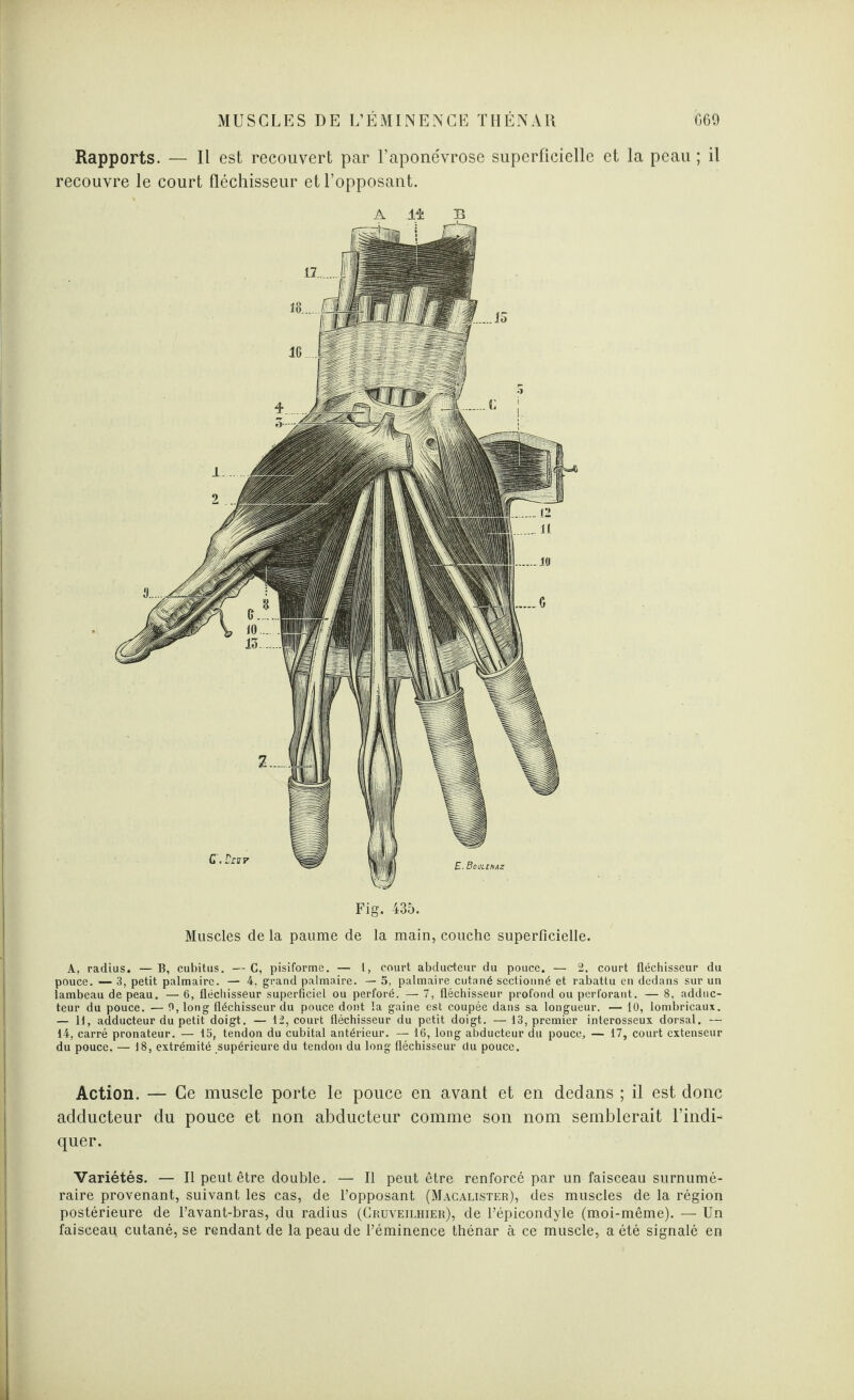 Rapports. — Il est recouvert par l’apone'vrose superficielle et la peau ; il recouvre le court fléchisseur et l’opposant. Fig. 435. Muscles de la paume de la main, couche superficielle. A, radius. — B, cubitus. — C, pisiforme. — 1, court abducteur du pouce. — 2, court fléchisseur du pouce. — 3, petit palmaire. — 4. grand palmaire. — 5, palmaire cutané sectionné et rabattu en dedans sur un lambeau de peau. — 6, fléchisseur superficiel ou perforé. — 7, fléchisseur profond ou perforant. —■ 8, adduc¬ teur du pouce. — 0, long fléchisseur du pouce dont la gaine est coupée dans sa longueur. — 10, lombricaux. — 11, adducteur du petit doigt. — 12, court fléchisseur du petit doigt. —13, premier interosseux dorsal. — 14, carré pronateur. — 15, tendon du cubital antérieur. — 16, long abducteur du pouce, — 17, court extenseur du pouce. — 18, extrémité supérieure du tendon du long fléchisseur du pouce. Action. — Ce muscle porte le pouce en avant et en dedans ; il est donc adducteur du pouce et non abducteur comme son nom semblerait l’indi¬ quer. Variétés. — Il peut être double. — Il peut être renforcé par un faisceau surnumé¬ raire provenant, suivant les cas, de l’opposant (Macalister), des muscles de la région postérieure de l’avant-bras, du radius (Cruveilhier), de l’épicondyle (moi-même). — Un faisceau, cutané, se rendant de la peau de l’éminence thénar à ce muscle, a été signalé en