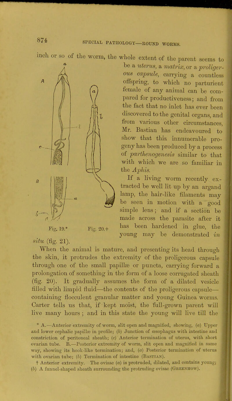 SPECIAL PATHOLOGY—ROUND WORMS. B inch or so of the worm, the whole extent of the parent seems to be a uterus, a matrix, or a proliger- 0U8 capsule, carrying a countless offspring, to which no parturient female of any animal can be com- pared for productiveness; and from the fact that no inlet has ever been discovered to the genital organs, and from various other circumstances, Mr. Bastian has endeavoured to show that this innumerable pro- geny has been produced by a process of parthenogenesis similar to that with which we are so familiar in the Aphis. If a living worm recently ex- tracted be well lit up by an argand lamp, the hair-like filaments may be seen in motion with a good simple lens; and if a section be made across the parasite after it has been hardened in glue, the young may be demonstrated in situ (fig. 21). When the animal is mature, and presenting its head through the skin, it protrudes the extremity of the proligerous capsule through one of the small papillae or puncta, carrying forward a prolongation of something in the form of a loose corrugated sheath (fig. 20). It gradually assumes the form of a dilated vesicle tilled with limpid fluid—the contents of the proligerous capsule— containing flocculeut granular matter and young Guinea worms. Carter tells us that, if kept moist, the full-grown parent will live many hours ; and in this state the young will live till the * A.—Anterior extremity of worm, slit open and magnified, s^^o^A^ng, (a) Ujiper and lower cephalic painllas in profile; (h) Junction of CESO])hagus with intestine and constriction of peritoneal sheath; (c) Anterior termination of uterus, with short ovarian tube. B,—Posterior extremity of worm, slit open and magnified in same way, showing its hook-like termination; and, (a) Posterior termination of uterus with ovarian tube; (b) Termination of intestine (Bastian). t Anterior extremity. The ovisac {a) is protruded, dilated, and contains young; (h) A funnel-shaped sheath surrounding the protruding OA-isac (Gbeenhow). Pig. 19.^ Fig. 20.+