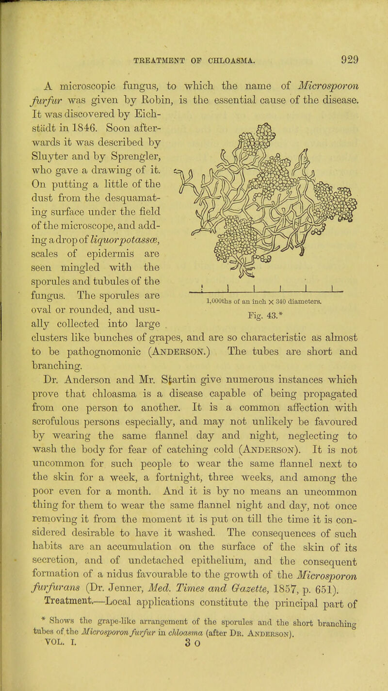 1 l,000thB of an inch X 340 diameters. Fig. 43.* A microscopic fungus, to which the name of Microsporon fiirfiir was given by Robin, is the essential cause of the disease. It was discovered by Eich- stiidt in 1846. Soon after- wards it was described by Slujrter and by Sprengler, who gave a drawing of it. On putting a little of the dust from the desquamat- ing surface under the field of the microscope, and add- ing a drop of liquor potassce, scales of epidermis are seen mingled with the sporules and tubules of the fungus. The sporules are oval or rounded, and usu- ally collected into large clusters like bunches of grapes, and are so characteristic as almost to be pathognomonic (Anderson.) The tubes are short and branching. Dr. Anderson and Mr. Startin. give numerous instances which prove that chloasma is a disease capable of being propagated from one person to another. It is a common affection with scrofulous persons especially, and may not unlikely be favoured by wearing the same flannel day and night, neglecting to wash the body for fear of catching cold (Anderson). It is not uncommon for such people to wear the same flannel next to the skin for a week, a fortnight, three weeks, and among the poor even for a month. And it is by no means an uncommon thing for them to wear the same flannel night and day, not once removing it from the moment it is put on till the time it is con- sidered desirable to have it washed. The consequences of such habits are an accumulation on the surface of the skin of its secretion, and of undetached epithelium, and the consequent formation of a nidus favourable to the growth of the Microsporon farfurans (Dr. Jenner, Med. Times and Gazette, 1857, p. 651). Treatment—Local applications constitute the principal part of * Shows the grape-like arrangement of the sporules and the short branching tubes of the Microsporon furfur in chloasma (after Dr. Anderson)  VOL. L 3 O