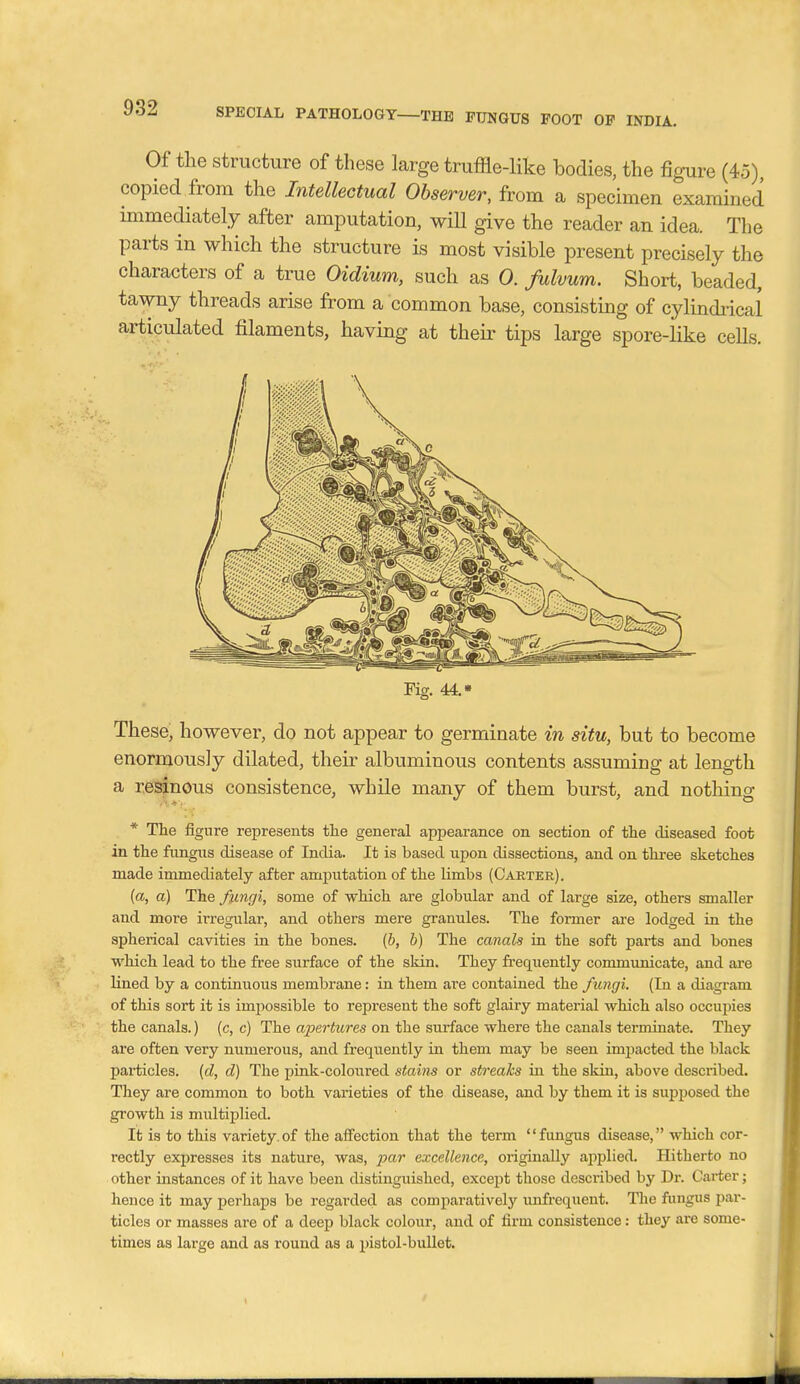 Of the structure of these large truffle-like bodies, the figure (45) copied from the Intellectual Observer, from a specimen examined immediately after amputation, will give the reader an idea. The parts in which the structure is most visible present precisely the characters of a true Oidium, such as 0. Julvum. Short, beaded, tawny threads arise from a common base, consisting of cylindrical articulated filaments, having at theii' tips large spore-like cells. Fig. 44. • These, however, do not appear to germinate in situ, but to become enormously dilated, their albuminous contents assuming at length a resinous consistence, while many of them burst, and nothing * The figure represents the general appearance on section of the diseased foot in the fungus disease of India. It is based upon dissections, and on three sketches made immediately after amputation of the limbs (Carter). (a, a) The fungi, some of which are globular and of large size, others smaller and more irregular, and others mere granules. The former are lodged in the spherical cavities in the bones. [h, h) The canals in the soft parts and bones which lead to the free surface of the skin. They frequently communicate, and are lined by a continuous membrane: in them are contained the fungi. (lu a diagram of this sort it is imjjossible to represent the soft glairy material which also occupies the canals.) (c, c) The apertures on the surface where the canals terminate. They are often very numerous, and frequently in them may be seen impacted the black particles, {cl, d) The pink-coloured stains or streaks in the skin, above described. They are common to both varieties of the disease, and by them it is supposed the growth is multiplied. It is to this variety.of the affection that the term fungus disease, which cor- rectly expresses its nature, was, par excellence, originally aj^plied. Hitherto no other instances of it have been distinguished, except those described by Dr. Carter; hence it may perhaps be regarded as comparatively unfrequent. The fungus par- ticles or masses are of a deep black colour, and of firm consistence: they are some- times as large and as round as a pistol-bullet.