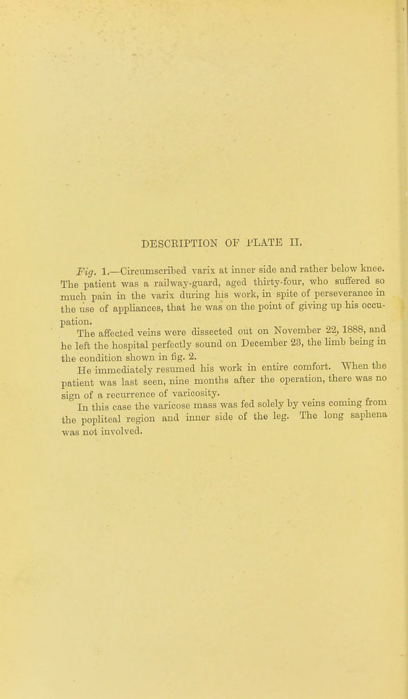 Fig. 1.—Circumscribed varix at inner side and rather below knee. The patient was a railway-guard, aged thirty-four, who suffered so much pain in the varix during his work, in spite of perseverance in the use of appliances, that he was on the point of giving up his occu- pation. The affected veins were dissected out on November 22, 1888, and he left the hospital perfectly sound on December 23, the limb being in the condition shown in fig. 2. He immediately resumed his work in entire comfort. When the patient was last seen, nine months after the operation, there was no si<m of a recurrence of varicosity. In this case the varicose mass was fed solely by veins coming from the popliteal region and inner side of the leg. The long saphena was not involved.