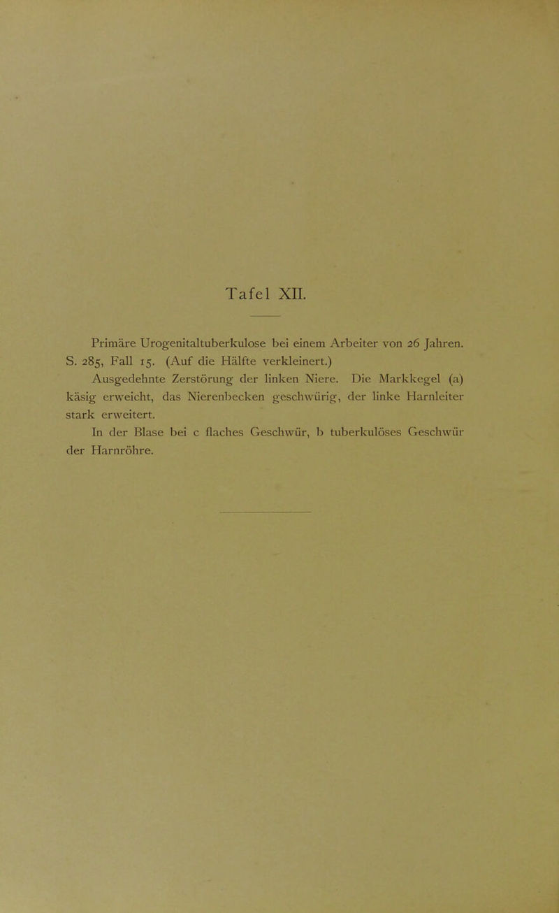 Primäre Urogenitaltuberkulose bei einem Arbeiter von 26 Jahren. S. 285, Fall 15. (Auf die Hälfte verkleinert.) Ausgedehnte Zerstörung der linken Niere. Die Markkegel (a) käsig erweicht, das Nierenbecken geschwürig, der linke Harnleiter stark erweitert. In der Blase bei c flaches Geschwür, b tuberkulöses Geschwin- der Harnröhre.