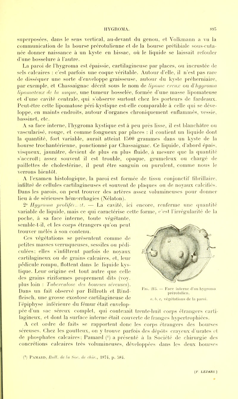 superposées, dans le sens vertical, au-devant du genou, et Volkmann a vu la communication de la bourse prérotulienne et de la bourse prctibiale sous-cula- née donner naissance à un kyste en bissac, où le liquide se laissait refoulei' d'une bosselure à l'autre. La paroi de l'hygroma est épaissie, cartilagineuse par places, ou incrustée de sels calcaires : c'est parfois une coque véritable. Autovu- d'elle, il n'est pas rare de disséquer une sorte d'enveloppe graisseuse, autour du kyste préherniaire, par exemple, et Chassaignac décrit sous le nom de lipome creux ou àliijgroma lipomateux de lu nuque, une tumeur bosselée, formée d'une masse lipomateuse et d'une cavité centrale, qui s'observe surtout chez les porteurs de fardeaux. Peut-être celte lipomatose péri-kystique est-elle comparable à celle qui se déve- loppe, en maints endroits, autour d'organes chroniquement enflammés, vessie, bassinet, etc. A sa face interne, l'hygroma kystique est à peu près lisse, il est blanchâtre ou vascularisé, rouge, et comme fongueux par places : il contient un liquide dont la quantité, fort variable, aurait atteint 1500 grammes dans un kyste de la bourse trochantérienne, ponctionné par Chassaignac. Ce liquide, d'abord épais, visqueux, jaunâtre, devient de plus en plus fluide, à mesure que la quantité s'accroît; assez souvent il est trouble, opaque, grumeleux ou chargé de paillettes de cholestérine, il peut être sanguin ou purulent, comme nous le verrons bientôt. A l'examen hislologique, la paroi est formée de tissu conjonctif fibrillaire, infiltré de cellules cartilagineuses et souvent de plaques ou de noyaux calcifiés. Dans les parois, on peut trouver des artères assez volumineuses pour donner lieu à de sérieuses hémorrhagies (Nélaton). 2° Hygroma proUféi\, it. — La cavité, ici encore, renferme une quantité variable de liquide, mais ce qui caractérise cette forme, c'est l'irrégularité de la poche, à sa face interne, toute végétante, semble-t-il, et les corps étrangers qu'on peut trouver mêlés à son contenu. Ces végétations se présentent comme de petites masses verruqueuses, sessiles ou pédi- culées; elles s'infiltrent parfois de noyaux cartilagineux ou de grains calcaires, et, leur pédicule rompu, flottent dans le liquide kys- tique. Leur origine est tout autre que celle des grains riziformes proprement dits (voy. plus loin : Tuberculose des bourses sérei(ses). Dans un fait observé par Billroth et Rind- tleisch, une grosse exostose cartilagineuse de l'épiphyse inférieure du fémur était envelop- pée d'un sac séreux complet, qui contenait trente-huit corps étrangci's carti- lagineux, et dont la surface interne était couverte de franges hypertrophiées. A cet ordre de faits se rapportent donc les corps étrangers des bourses séreuses. Chez les goutteux, on y trouve parfois des dépiMs crayeux d'urates et de i)hosphates calcaires; Pamard (') a présenté à la Société de chirurgie des concrétions calcaires très volumineuses, développées dans les deux bourses Fie. '2lo. — Face interne d'un hygroma préroUilieii. 0, b. c, végétations de la paroi. (') Pamard, Bull, de la Sur. de cliir., 1874, p. 584.