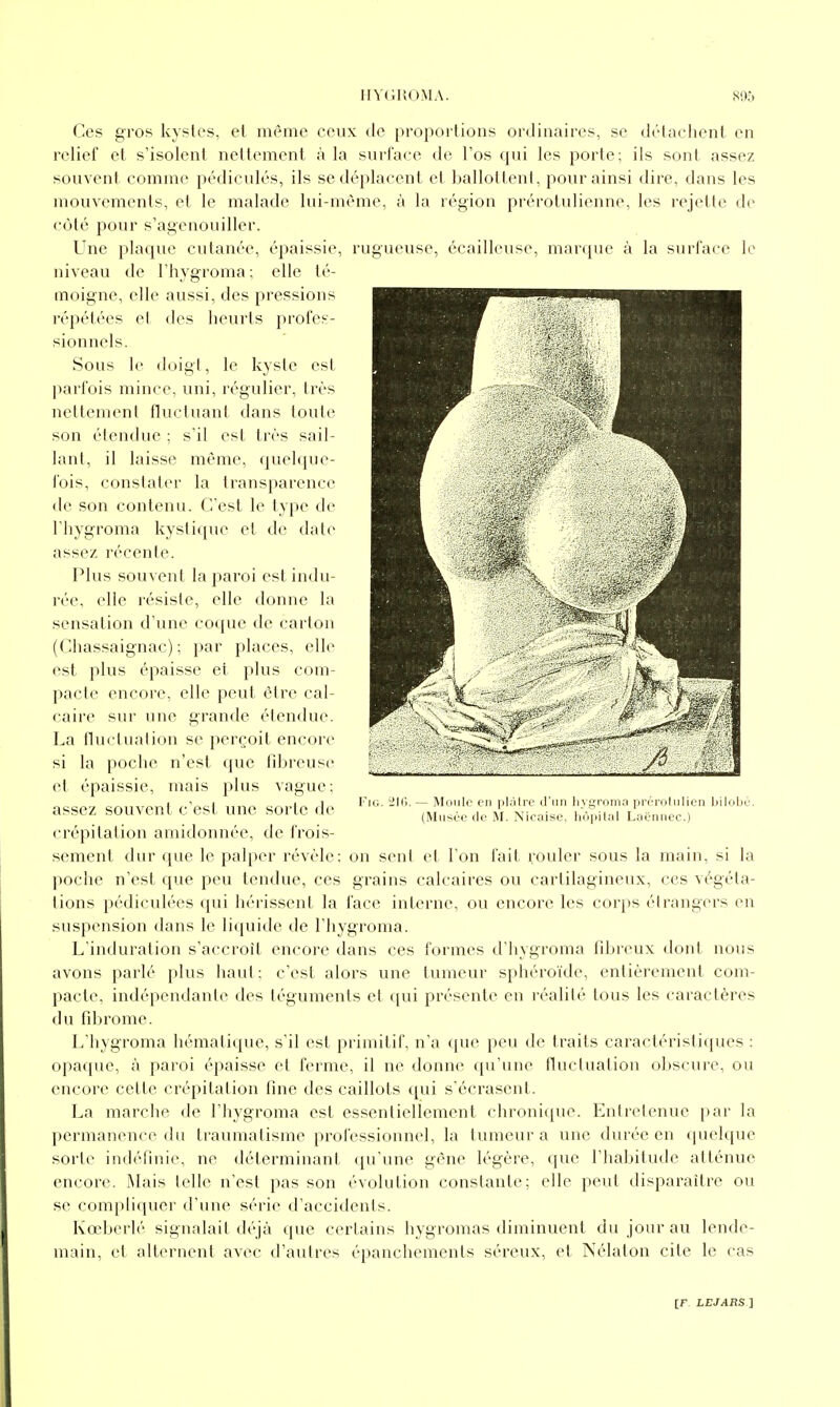 Ces gros kystes, et même ceux de proportions ordinaires, se détachent en relief et s'isolent nettement à la surface de l'os qui les porte; ils sont assez souvent, comme pédicules, ils se déplacent et ballottent, pour ainsi dire, dans les jnouvements, et le malade lui-même, à la région prérotulienne, les rejette de côté pour s'agenouiller. Une plaque cutanée, épaissie, rugueuse, écailleuse, marque à la surface le niveau de l'hygroma; elle té- moigne, elle aussi, des pressions répétées et des heurts profes- sionnels. Sous le doigt, le kyste est parfois mince, uni, régulier, très nettement fluctuant dans toute son étendue ; s'il est très sail- lant, il laisse même, quelque- fois, constater la transparence de son contenu. C'est le type de l'hygroma kystique et de date assez récente. Plus souvent la paroi est indu- rée, elle résiste, elle donne la sensation d'une coque de carton (Chassaignac) ; par places, elle est plus épaisse et plus com- pacte encore, elle peut être cal- caire sur une grande étendue. La fluctuation se perçoit encore si la poche n'est que fibreuse et épaissie, mais plus vague; assez souvent c'est une sorte de crépitation amidonnée, de frois- sement dur que le palper révèle; on sent cl l'on fait rouler sous la main, si la poche n'est que peu tendue, ces grains calcaires ou cartilagineux, ces végéta- tions pédiculées qui hérissent la face interne, ou encore les corps étrangers en suspension dans le liquide de l'hygroma. L'induration s'accroît encore dans ces formes d'hygroma fibreux dont nous avons parlé plus haut : c'est alors une tumeur sphéroïde, entièrement com- pacte, indépendante des téguments et qui présente en réalité tous les caractères du fibrome. L'hygroma hémaliquc, s'il est primitif, n'a ([uc peu de traits caractéristiques : opaque, à paroi épaisse et ferme, il ne donne qu'une fluctuation obscure, ou encore cette crépitation fine des caillots qui s'écrasent. La marche de l'hygroma est essentiellement chronique. Entretenue par la permanence du traumatisme professionnel, la tumeur a une durée en (|uelque sorte indéfinie, ne déterminant qu'une gène légère, que l'habitude atténue encore. Mais telle n'est pas son évolution constante; elle peut disparaître ou se compliquer d'une série d'accidents. Kœberlé signalait déjà que certains hygromas diminuent du jour au lende- main, et alternent avec d'autres épanchements séreux, et Nélaton cite le cas — iMtiulc C'ji plâtre d'un hygrom;i prùroliilicn bilobe (Musée de M. Nicaise, hôpital Laëniicc.)