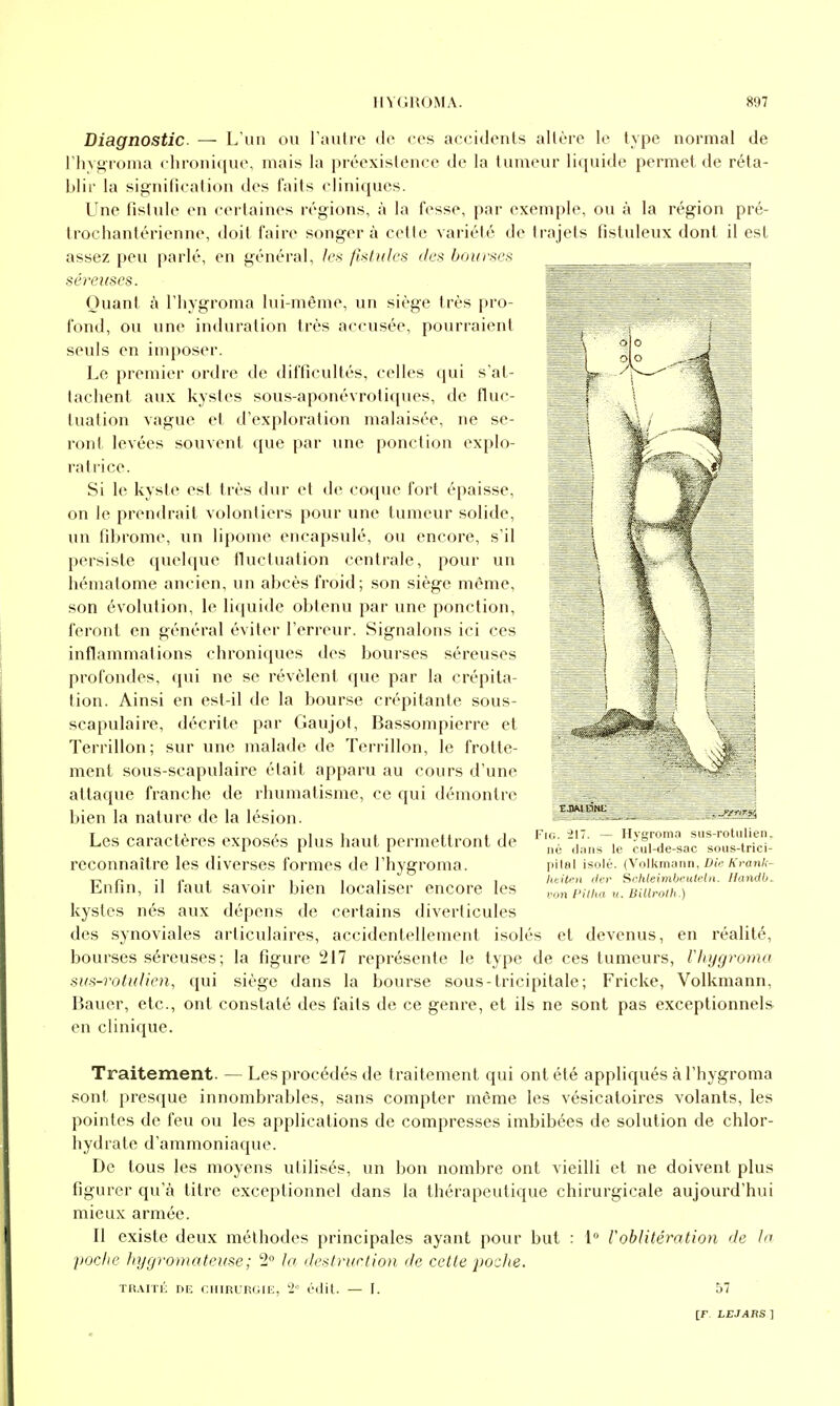 Diagnostic. — L'un ou l'autre do ces accidents altère le type normal de rhvgroma (•hroni([ue, mais la préexistence de la tumeur liquide permet, de réta- blir la signification des faits cliniques. Une fistule en certaines régions, à la fesse, par exemple, ou à la région pré- trochantérienne, doit faire songera cette variété de trajets fisluleux dont il est assez peu parlé, en général, /es /Utulcs dcx bour>ies séreuses. Quant h l'hygroma lui-même, un siège très pro- fond, ou une induration très accusée, pourraient seuls en imposer. Le premier ordre de difficultés, celles qui s'at- tachent aux kystes sous-aponévrotiques, de fluc- tuation vague et d'exploration malaisée, ne se- ront levées souvent que par une ponction explo- ratrice. Si le kyste est très dur et de coque fort épaisse, on le prendrait volontiers pour une tumeur solide, un fibrome, un lipome encapsulé, ou encore, s'il persiste quelque nuctuation centrale, pour un hématome ancien, un abcès froid; son siège même, son évolution, le liquide obtenu par une ponction, feront en général éviter l'erreur. Signalons ici ces inflammations chroniques des bourses séreuses profondes, qui ne se révèlent que par la crépita- tion. Ainsi en est-il de la bourse crépitante sous- scapulaire, décrite par Gaujot, Bassompierre et Terrillon; sur une malade de Terrillon, le frotte- ment sous-scapulaire était apparu au cours d'une attaque franche de rhumatisme, ce qui démontre bien la nature de la lésion. Les caractères exposés plus haut permettront de reconnaître les diverses formes de l'hygroma. Enfin, il faut savoir bien localiser encore les kystes nés aux dépens de certains diverticules des synoviales articulaires, accidentellement isolés et devenus, en réalité, bourses séreuses; la figure 217 représente le type de ces tumeurs, l'hygroma svs-rotuUen, qui siège dans la bourse sous-tricipitale; Fricke, Volkmann, Bauer, etc., ont constaté des faits de ce genre, et ils ne sont pas exceptionnels en clinique. FiG. -217. - Ilygruiii.i siis-rotulien, lie ilniis le cul-de-sac sous-trici- pilal isolé. (Volkmann, D'u; Krank- litilpn der Sckleimhcutrlii. Handb. von l'illia u. BUlrolli.) Traitement. — Les procédés de traitement qui ont été appliqués à l'hygroma sont presque innombrables, sans compter même les vésicatoires volants, les pointes de feu ou les applications de compresses imbibées de solution de chlor- hydrate d'ammoniaque. De tous les moyens utilisés, un bon nombre ont vieilli et ne doivent plus figurer qu'à titre exceptionnel dans la thérapeutique chirurgicale aujourd'hui mieux armée. Il existe deux méthodes principales ayant pour but : 1 rohlitération de In poche JnjQromateKse; 2 hy ilestrurtion de celle poche. ÏR.\ITÉ DF, CHIRURGIE, 2 édit. — I. 57