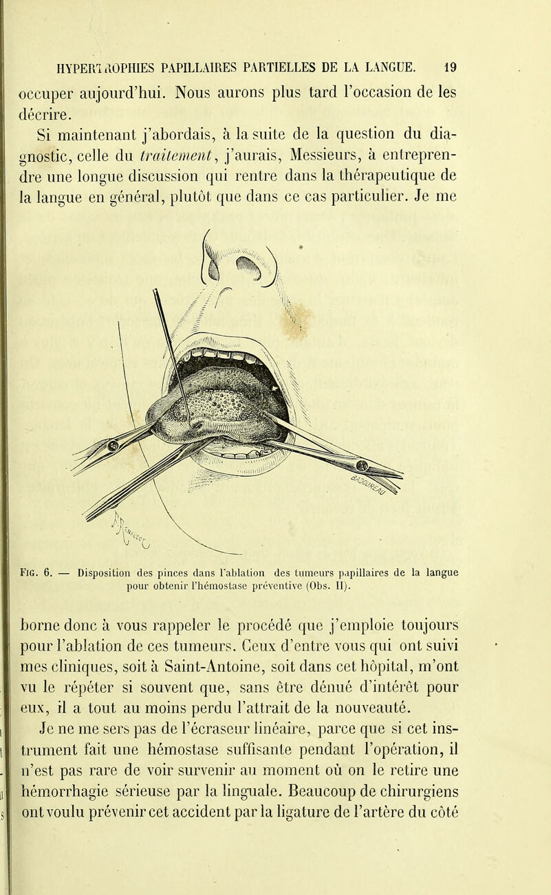 occuper aujourd'hui. Nous aurons plus tard l'occasion de les décrire. Si maintenant j'abordais, à la suite de la question du dia- gnostic, celle du trailement, j'aurais, Messieurs, à entrepren- dre une longue discussion qui rentre dans la thérapeutique de la langue en général, plutôt que dans ce cas particulier. Je me FiG. 6. — Disposition des pinces dans Tablalion des tumeurs papiUaires de la langue pour obtenir l'hémostase préventive (Obs. II). borne donc à vous rappeler le procédé que j'emploie toujours pour l'ablation de ces tumeurs. Ceux d'entre vous qui ont suivi mes cliniques, soit à Saint-Antoine, soit dans cet hôpital, m'ont vu le répéter si souvent que, sans être dénué d'intérêt pour eux, il a tout au moins perdu l'attrait de la nouveauté. Je ne me sers pas de l'écraseur linéaire, parce que si cet ins- trument fait une hémostase suffisante pendant l'opération, il n'est pas rare de voir survenir au moment où on le retire une hémorrhagie sérieuse par la linguale. Beaucoup de chirurgiens ont voulu prévenir cet accident par la ligature de l'artère du côté