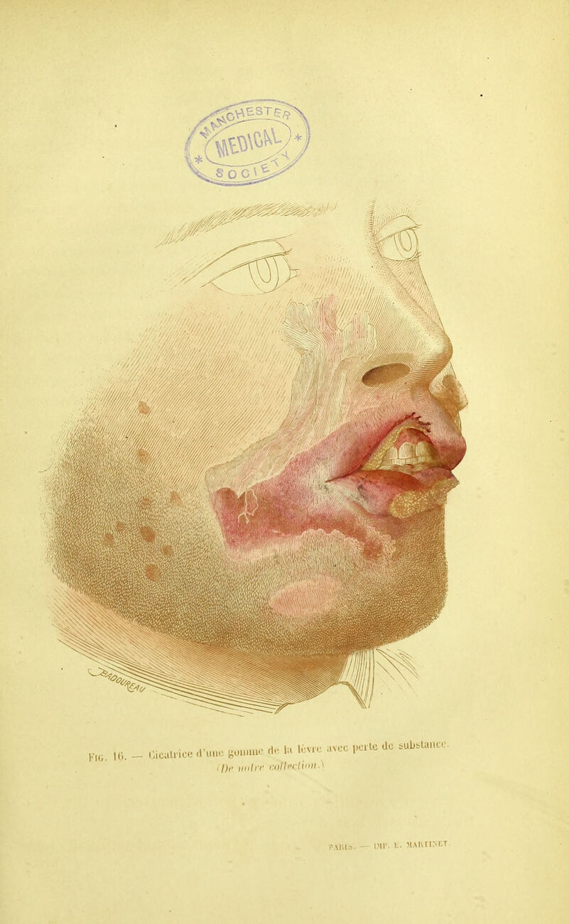 ilh> iiiilrr i:ollcrHiii>- PAlila. — m>. E. MAHtl>XT