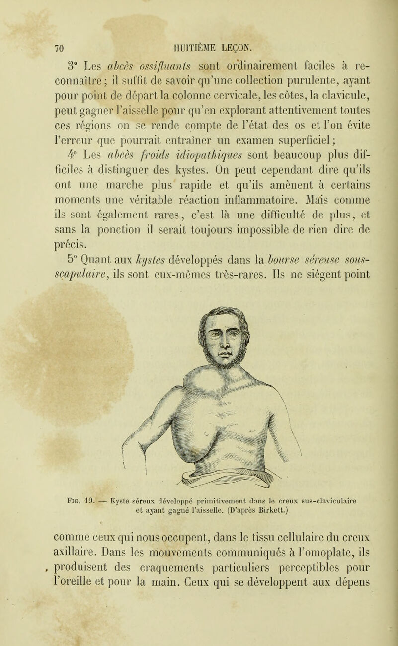3° Les ahcès ossifluanls sont ordinairement faciles à re- connaître ; il suffît de savoir qu'une collection purulente, ayant pour point de départ la colonne cervicale, les côtes, la clavicule, peut gagner l'aisselle pour qu'en explorant attentivement toutes ces régions on se rende compte de l'état des os et l'on évite l'erreur que pourrait entraîner un examen superficiel ; 4° Les abcès froids idiopatJiiqiics sont beaucoup plus dif- ficiles à distinguer des kystes. On peut cependant dire qu'ils ont une marche plus rapide et qu'ils amènent à certains moments une véritable réaction inflammatoire. Mais comme ils sont également rares, c'est là une difficulté de plus, et sans la ponction il serait toujours impossible de rien dire de précis. 5° Quant aux kystes développés dans la bourse séreuse sous- scapidairc, ils sont eux-mêmes très-rares. Ils ne siègent point FiG. 19. — Kyste séreux développé primitivement dnns le creux sus-claviculaire et ayant gagné l'aisselle. (D'après Birkett.) comme ceux qui nous occupent, dans le tissu cellulaire du creux axillaire. Dans les mouvements communiqués à l'omoplate, ils . produisent des craquements particuliers perceptibles pour l'oreille et pour la main. Ceux qui se développent aux dépens