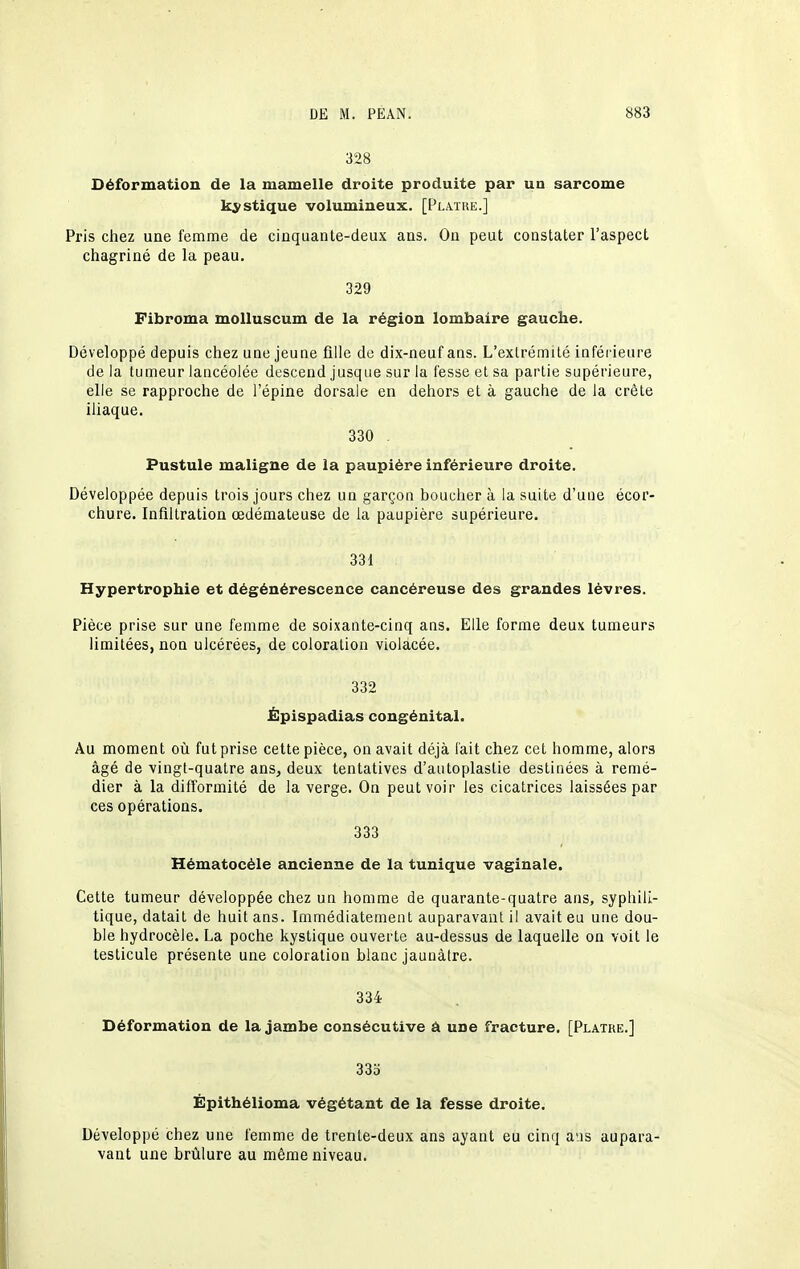 328 Déformation de la mamelle droite produite par un sarcome kj^stique volumineux. [Platue.] Pris chez une femme de cinquante-deux ans. Ou peut constater l'aspect chagriné de la peau. 329 Fibroma molluscum de la région lombaire gauche. Développé depuis chez une jeune fille de dix-neuf ans. L'extrémité inférieure de la tumeur lancéolée descend jusque sur la fesse et sa partie supérieure, elle se rapproche de l'épine dorsale en dehors et à gauche de la crête ihaque. 330 . Pustule maligne de la paupière inférieure droite. Développée depuis trois jours chez un garçon boucher à la suite d'une écor- chure. Infiltration œdémateuse de la paupière supérieure. 331 Hypertrophie et dégénérescence cancéreuse des grandes lèvres. Pièce prise sur une femme de soixante-cinq ans. Elle forme deux tumeurs limitées, non ulcérées, de coloration violacée. 332 Épispadias congénital. Au moment où fut prise cette pièce, on avait déjà lait chez cet homme, alors âgé de vingt-quatre ans, deux tentatives d'autoplastie destinées à remé- dier à la difformité de la verge. On peut voir les cicatrices laissées par ces opérations. 333 Hématocéle ancienne de la tunique vaginale. Cette tumeur développée chez un homme de quarante-quatre ans, syphili- tique, datait de huit ans. Immédiatement auparavant il avait eu une dou- ble hydrocèie. La poche kystique ouverte au-dessus de laquelle on voit le testicule présente une coloration blanc jaunâtre. 334 Déformation de la jambe consécutive â une fracture. [Plâtre.] 333 Ëpithélioma végétant de la fesse droite. Développé chez une femme de trente-deux ans ayant eu cinq ans aupara- vant une brûlure au même niveau.