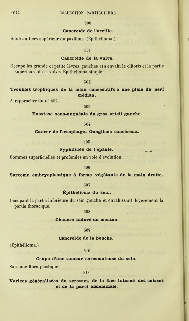 500 Cancroïde de Poreille. Situé au tiers supérieur du pavillon. (Épithélioma.) 501 Cancroïde de la vulve. Occupe les grande et petite lèvres gauches et a envahi le clitoris et la partie supérieure de la vulve. Épithélioma simple. 502 Troubles trophiques de la main consécutifs à une plaie du nerf médian. A rapprocher du n 452. 503 Ezostose sous-unguéale du gros orteil gauche. 504 Cancer de Tœsophage. Ganglions cancéreux. 505 Syphilides de l'épaule. _ ^ Gommes superficielles et profondes en voie d'évolution. 506 Sarcome embryoplastique à forme végétante de la main droite. 507 Épithélioma du sein. Occupant la partie inférieure du sein gauche et envahissant légèrement la partie thoracique. 508 Chancre induré du menton. 509 Cancroïde de la bouche. (Épithéhoma.) 510 Coupe d'une tumeur sarcomateuse du sein. Sarcome tibro-plastique. 611 Varices généralisées du scrotum, de la face interne des cuisses et de la paroi abdominale.