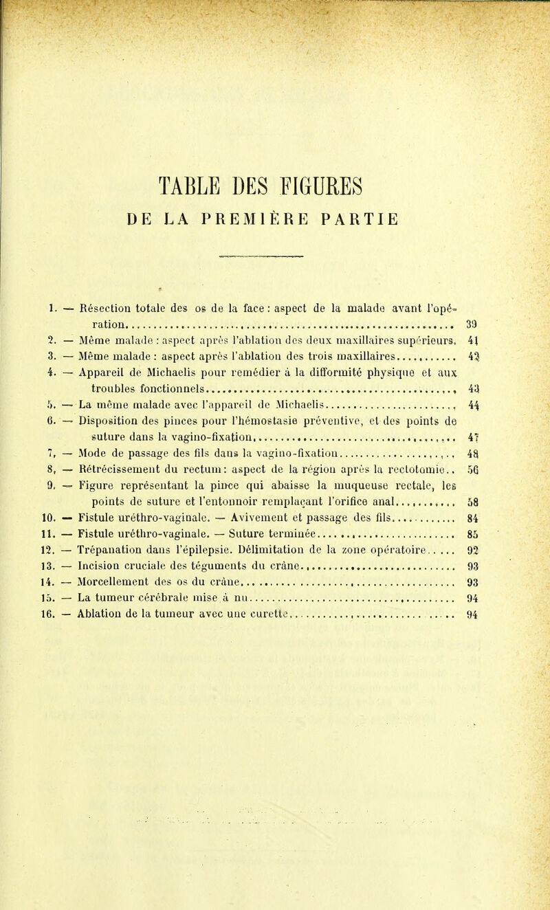 DE LA PREMIÈRE PARTIE 1. — Résection totale des os de la face: aspect de la malade; avant l'opé- ration 39 2. — Même malade : aspect après l'ablation des deux maxillaires supérieurs, 41 3. — Même malade : aspect après l'ablation des trois maxillaires 43 4. — Appareil de Michaelis pour remédier à la difformité physique et aux troubles fonctionnels ,., 43 5. — La même malade avec l'appareil de Michaelis 44. 6. — Disposition des pinces pour l'hémostasie préventive, et des points de suture dans la vagino-fixation ,... 4r 7. — Mode de passage des fils dans la vagioo-ûxatiou ,.,., 48 8. — Rétrécissement du rectum: aspect de la région après la reclotomie.. 56 9. — Figure représentant la pince qui abaisse la muqueuse rectale, les points de suture et l'entonnoir remplaçant l'orifice anal 58 10. — Fistule uréthro-vaginale. — Avivemeut et passage des fils 84 11. — Fistule uréthro-vaginale. — Suture terminée 85 12. — Trépanation dans l'épilepsie. Délimitation de la zone opératoire 92 13. — Incision cruciale des téguments du crâne 93 14. — Morcellement des os du crâne 93 15. — La tumeur cérébrale mise à nu 94 16. — Ablation de la tumeur avec une curette , 94