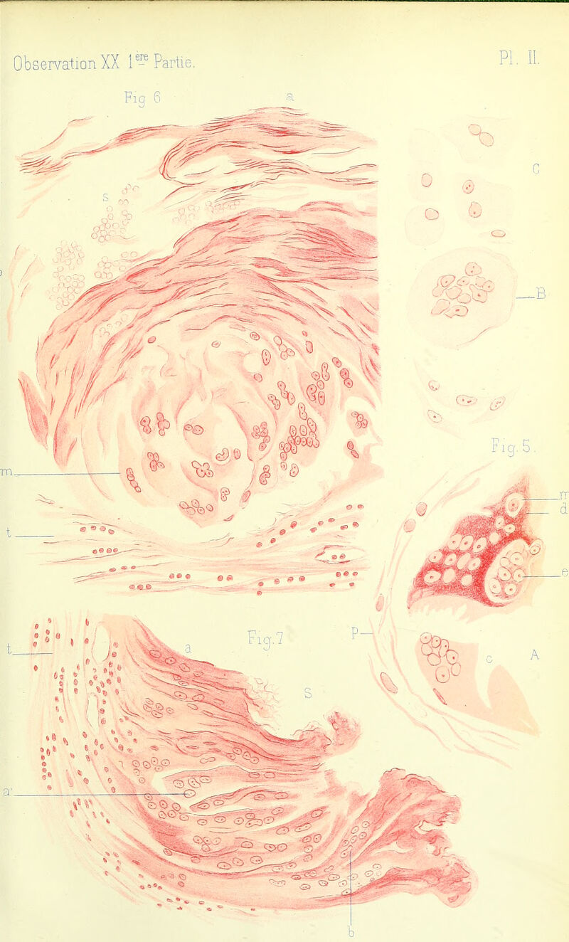Observation XX Partie. Pl. II.