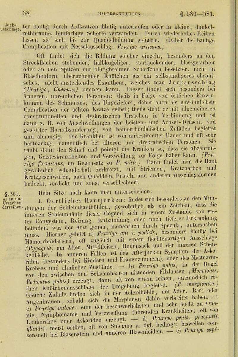 usschfflge. Um* häufig durch Aufkratzen blutig unterlaufen oder in kleine, dunkel- rothbraune, blutfarbige Schorfe verwandelt. Durch wiederholtes Heilten lassen sie sich bis zur Quadd'elbiMuüg steigern. (Daher die häufige Complication mit Nesselausschlag: Prurigo urticans.) Oft tindet sich die Bildung solcher einzeln, besonders an den Sireckflächen stehender, halbkugeliger, starkjuckender, blassgefärbter oder an den Spitzen mit blutigbraunen Schorfchen besetzter, nicht in Bläschenform übergehender Knötchen als ein selbständigeres chroni- sches, nicht ansteckendes Exanthem, welches mau Juckausschlag (Prurigo, CnesmusJ nennen kann. Dieser findet sich besonders bei ärmeren, unreinlichen Personen: theils in Folge von örtlichen Einwir- kungen des Schmutzes, des Ungeziefers, daher auch als gewöhnlichste Complication der ächten Krätze selbst; theils steht er mit allgemeineren constitutionellen und dyskratischen Ursachen in Verbindung und ist dann z. B. von Anschwellungen der Leisten- und Achsel-Drüsen, von gestörter Harriabsonderurtg, von hämorrhoTdalischen Zufällen begleitet und abhängig. Die Krankheit ist von unbestimmter Dauer und oft sehr hartnäckig, namentlich bei älteren und dyskratischen Personen. Sie raubt dann den Schlaf und peinigt die Kranken so, dass sie Abzehrun- gen, Geisteskrankheiten und Verzweiflung zur Folge haben kann. (Pru- rigo formicans, im Gegensatz zu P. mitis.) Dann findet man die Haut gewöhnlich schauderhaft zerkratzt, mit Striemen, Kratznarben und Kratzgeschwüren, auch Quaddeln, Pusteln und anderen Ausschlagsformen bedeckt, verdickt und sonst verschlechtert. §.581. Dem Sitze nach kann man unterscheiden: ursanci!end I- Oertliches Hautjucken: findet sich besonders an den Mün- derrseCiben. (i,in0(,n der Schleinihautböhlen, gewöhnlich als ein Zeichen, dass die inneren Schleimhäute dieser Gegend sich in einem Zustande von ste- ter Gongestion, Beizung, Entzündung oder noch tieferer Erkrankung befinden was der Arzt genau, namentlich durch Speeula, untersuchen muss. Hierher gehört a) Prurigo ani s. podicis, besonders häufig bei Hämorrhoidariern, oft zugleich mit einem flechtenartigen Ausschlage (Pyaagria) am After, Mittelfleisch, Hodensack und der inneren Schen- kelfläche/ In anderen Fällen ist das Afterjucken Symptom <eir Aska- riden (besonders bei Kindern und Frauenzimmern), oder des Mastdarm.. Krebses und ähnlicher Zustände. — b) Prurigo pubis, in de, K.gel ,!n den zwischen den Schaamhaaren nistenden Filzläusen Pediculus pubis) erzeugt, dann oft von ^.^VJ^S^j tben Knöfchenausschlage der Umgebung begleitet. (P. mV^^J Gleiche Zufälle finden sich in der Achselhöhle, um After Bart^dei Aule brauen, sobald sich die Morpionen dahin verbreitet haben - r\°P, riao vulvae- eine der beschwerlichsten und sehr leicht zu Ona- ne Shonanie und Verzweiflung führenden Krankheiten; oU von SÄ oder Askariden erzeugt. - %^J^J^ glandis, meist örtlich, oft von Smegma u. dgl^bedingt, »gw™ c0'_ sensuell bei Blasenstein und anderen Blasenleiden. - e) Prurigo capi