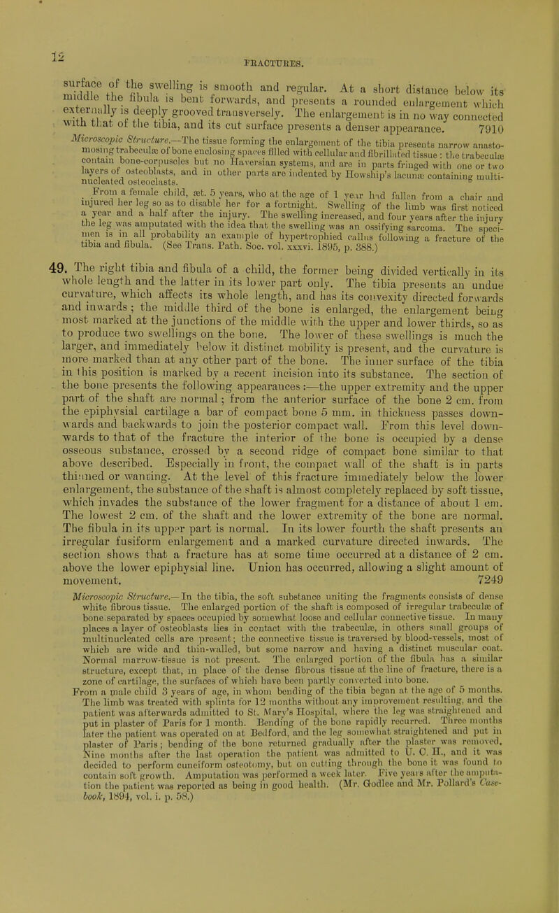 FEAOTTJBES. surface of the swelling is smooth and regular. At a short distance below its middle the hbula is bent forwards, and presents a rounded enlargement which externally is deeply grooved traasversely. The enlargement is in no way connected witn that ot the tibia, and its cut surface presents a denser appearance. 7910 Microscopic Strucfure--The tissue forming the enlargement of the tibia presents narrow anasto- mosing trnbeculro of bone enclosing spaces filled with cellular and fibrillMted tissue : the trabecula; contani bono-corin.sclos but no Haversian systems, and are in parts fringed with one or two Slttd?.!^^^^^^ ''^^''^^'^ Howship's lacunic containing multi- _ From a female child, years, who at the age of 1 year h^id fallen from a chair and injured her leg so as to disable her for a fortnight. Swelling of the limb was first noticed a year and a half after the injury. The swelling increased, and four years after the iniury the leg was amputated with the idea that the swelling was an ossifying sarcoma. The speci- men 13 in all probability an example of hypertrophied callus foUowing a fracture of the tibia and fibula. (See Trans. Path. Soc. vol. xsxri. 1895, p. 388.) 49. The right tibia and fibula of a child, the former being divided vertically in its whole length and the latter in its lower part only. The tibia presents an undue curvature, which aiSects its whole length, and has its convexity directed forvvards and inwards ; the middle third of the bone is enlarged, the enlargement being most marked at the junctions of the middle with the upper and lower thirds, so as to produce two swellings on the bone. The lower of these swellings is much the larger, and immediately below it distinct mobility is present, and the curvature is more marked than at any other part of the bone. The inner surface of the tibia in this position is marked by a recent incision into its substance. The section of the bone presents the following appearances:—the upper extremity and the upper part of the shaft are normal; from the anterior surface of the bone 2 cm. from the epiphysial cartilage a bar of compact bone 5 mm, in thickness passes down- wards and backwards to join the posterior compact wall. From this level down- wards to that of the fi-acture the interior of the bone is occupied by a dense osseous substance, crossed by a second ridge of compact bone similar to that above described. Especially in front, the compact wall of the shaft is in parts thinned or wanting. At the level of this fracture immediately below the lower enlargement, the substance of the shaft is almost completely replaced by soft tissue, which invades the substance of the lower fragment for a distance of about 1 cm. The lowest 2 cm. of the shaft and rhe lower extremity of the bone are normal. The fibula in its upper part is normal. In its lower fourth the shaft presents an irregular fusiform enlargement and a marked curvature directed inwards. The section shows that a fracture has at some time occurred at a distance of 2 cm. above the lower epiphysial line. Union has occurred, allowing a slight amount of movement. 7249 Microscopic Structure.—In the tibia, the soft substance uniting the fragments consists of dense white fibrous tissue. The enlarged portion of the shaft is composed of irregular trabeculas of bone separated by spaces occupied by somewhat loose and cellular connective tissue. In many places a layer of osteoblasts lies in contact with the trabecula3, in others small groups of multinucleated cells are present; the connective tissue is traversed by blood-vessels, most of which are wide and thin-walled, but some narrow and having a distinct muscular coat. Normal marrow-tissue is not present. The enlarged portion of the fibula has a similar structure, except that, in place of tlie dense fibrous tissue at the line of fracture, there is a zone of cartilage, the surfaces of which have been partly converted into bone. From a inale child 3 years of age, in whom bending of the tibia began at Ihe age of 5 moutlis. The limb was treated with splints for 12 months without any improvement resulting, and the patient was afterwards admitted to St. Mary's Hospital, where the leg was straigliieued and put in plaster of Paris for 1 month. Bending of the bone rapidly recurred. Three months later the patient was operated on at Bedford, and the leg somewhat straightened and put in plaster of Paris; bonding of the bono returned gradually after the pla.stor was removed. Nine montlis after the last operation the patient was admitted to U. 0. H., and it was decided to perform cuneiform osleotcmiy, but on cutting through llie bone it was found to contain soft growth. Amputation was performed a week later. Five yeai s alter the ani]Dutii- tion the patient was reported as being in good health. (Mr. Godlee and Mr. Pollard's Ciu>c- book, 1894, vol. i. p. 58.)