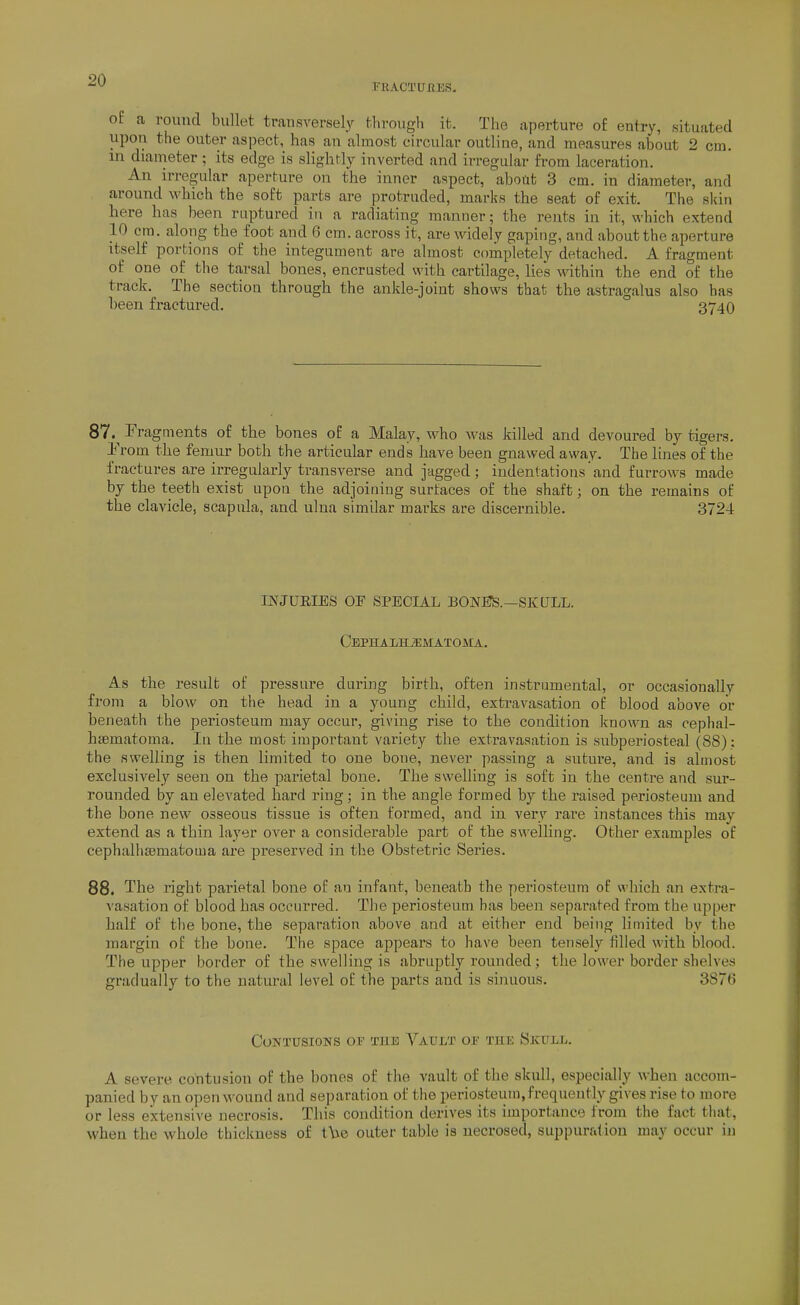 FRACa'UIlES. of a round bullet trausversely through it. The aperture of entry, situated upon the outer aspect, has an almost circular outline, and measures about 2 cm. in diameter ; its edge is slightly inverted and irregular from laceration. An irregular aperture on the inner aspect, about 3 cm. in diameter, and around which the soft parts are protruded, marks the seat of exit. The skin here has been raptured in a radiating manner; the rents in it, which extend 10 cm. along the foot and 6 cm. across it, are widely gaping, and about the aperture itself portions of the integument are almost completely detached. A fragment of one of the tarsal bones, encrusted with cartilage, lies wdthin the end of the track. The section through the ankle-joint shows that the astragalus also has been fractured. 3740 87.^ Fragments of the bones of a Malay, who was killed and devoured by tigers. Yrom the femur both the articular ends have been gnawed away. The lines of the fractures are irregularly transverse and jagged ; indentations and furrows made by the teeth exist upon the adjoining surfaces of the shaft; on the remains of the clavicle, scapula, and ulna similar marks are discernible. 3724 INJUEIES OF SPECIAL BONS?S.—SKULL. CbPHALHjEISIATOMA. As the result of pressure during birth, often instrumental, or occasionally from a blow on the head in a young child, extravasation of blood above or beneath the periosteum may occur, giving rise to the condition known as oephal- hsematoma. In the most important variety the extravasation is subperiosteal (88): the swelling is then limited to one bone, never passing a suture, and is almost exclusively seen on the parietal bone. The swelling is soft in the centre and sur- rounded by an elevated hard ring; in the angle formed by the raised periosteum and the bone new osseous tissue is often formed, and in very rare instances this may extend as a thin layer over a considerable part of the swelling. Other examples of cephalhsematoma are preserved in the Obstetric Series. 88. The right parietal bone of an infant, beneath the periosteum of which an extra- vasation of blood has occurred. The periosteum has been separated from the upper half of the bone, the separation above and at either end being limited by the margin of the bone. The space appears to have been tensely filled with blood. The upper border of the swelling is abruptly rounded; the lower border shelves gradually to the natural level of the parts and is sinuous. 3870 Contusions of the Vault or the Skull. A severe contusion of the honos of the vault of the skull, especially when accom- panied by an open wound and separation of the periosteum, frequently gives rise to more or less extensive necrosis. This condition derives its importance from the fact that, when the whole thickness of t\\e outer table is necrosed, suppuration may occur in
