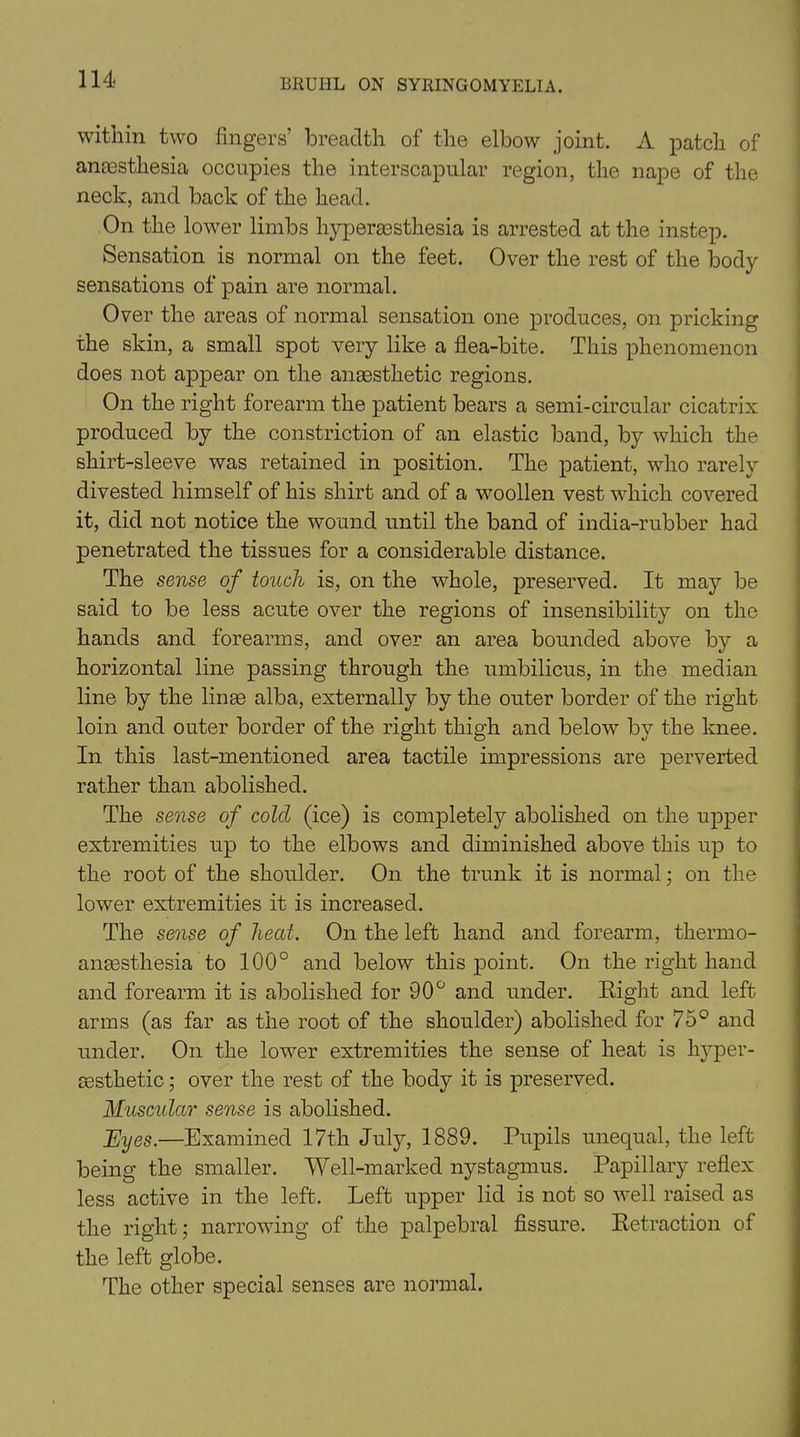 within two fingers’ breadth of the elbow joint. A patch of anaesthesia occupies the interscapular region, the nape of the neck, and back of the head. On the lower limbs hyperassthesia is arrested at the instep. Sensation is normal on the feet. Over the rest of the body sensations of pain are normal. Over the areas of normal sensation one produces, on pricking the skin, a small spot very like a flea-bite. This phenomenon does not appear on the anaesthetic regions. On the right forearm the patient bears a semi-circular cicatrix produced by the constriction of an elastic band, by which the shirt-sleeve was retained in position. The patient, who rarely divested himself of his shirt and of a woollen vest which covered it, did not notice the wound until the band of india-rubber had penetrated the tissues for a considerable distance. The sense of touch is, on the wdiole, preserved. It may be said to be less acute over the regions of insensibility on the hands and forearms, and over an area bounded above by a horizontal line passing through the umbilicus, in the median line by the linoe alba, externally by the outer border of the right loin and outer border of the right thigh and below7 by the knee. In this last-mentioned area tactile impressions are perverted rather than abolished. The sense of cold (ice) is completely abolished on the upper extremities up to the elbows and diminished above this up to the root of the shoulder. On the trunk it is normal; on the lower extremities it is increased. The sense of heat. On the left hand and forearm, thermo- anoesthesia to 100° and below this point. On the right hand and forearm it is abolished for 90° and under. Right and left arms (as far as the root of the shoulder) abolished for 75° and under. On the lower extremities the sense of heat is hyper- aesthetic ; over the rest of the body it is preserved. Muscular sense is abolished. JEiyes.—Examined 17th July, 1889. Pupils unequal, the left being the smaller. Well-marked nystagmus. Papillary reflex less active in the left. Left upper lid is not so well raised as the right; narrowing of the palpebral fissure. Retraction of the left globe. The other special senses are normal.
