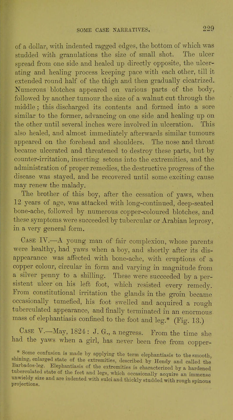 of a dollar, with indented ragged edges, the bottom of which was studded with granulations the size of small shot. The ulcer spread from one side and healed up directly opposite, the ulcer- ating and healing process keeping pace with each other, till it extended round half of the thigh and then gradually cicatrized. Numerous blotches appeared on various parts of the body, followed by another tumour the size of a walnut cut through the middle; this discharged its contents and formed into a sore similar to the former, advancing on one side and healing up on the other until several inches were involved in ulceration. This also healed, and almost immediately afterwards similar tumours appeared on the forehead and shoulders. The nose and throat became ulcerated and threatened to destroy these parts, but by counter-irritation, inserting setons into the extremities, and the administration of proper remedies, the destructive progress of the disease was stayed, and he recovered until some exciting cause may renew the malady. The brother of this boy, after the cessation of yaws, when 12 years of age, wras attacked with long-continued, deep-seated bone-ache, followed by numerous copper-coloured blotches, and these symptoms were succeeded by tubercular or Arabian leprosy, in a very general form. Case I\.—A young man of fair complexion, whose parents were healthy, had yaws when a boy, and shortly after its dis- appearance was affected with bone-ache, with eruptions of a copper colour, circular in form and varying in magnitude from a silver penny to a shilling. These were succeeded by a per- sistent ulcer on his left foot, which resisted every remedy. From constitutional irritation the glands in the groin became occasionally tumefied, his foot swelled and acquired a rough tuberculated appearance, and finally terminated in an enormous mass of elephantiasis confined to the foot and leg.* (Fig. 13.) C ase A . A [ay, 1824 : J. G., a negress. From the time she had the yaws when a girl, has never been free from copper- * Some confusion is made by applying the term elephantiasis to the smooth, shmmg, enlarged state of the extremities, described by Hendy and called the Barbados-leg. Elephantiasis of the extremities is characterized by a hardened tuberculated state of the feet and legs, which occasionally acquire an immense unwieldy size and are indented with sulci and thickly studded with rough spinous