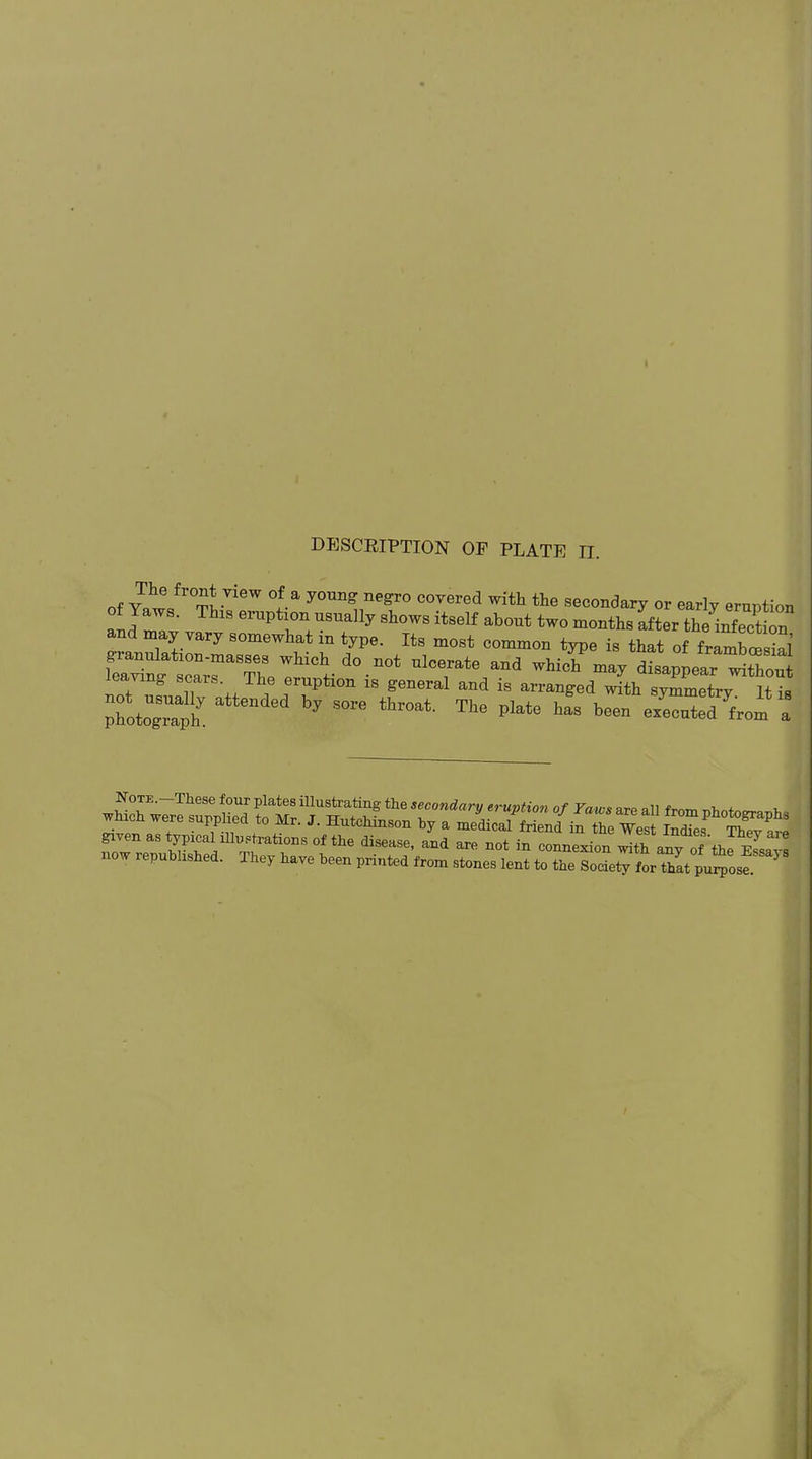 DESCRIPTION OF PLATE II. of v,tfr0^Vi6W °5a y°Ung negr° COVerecl with the secondary or early eruption Yaws. This eruption usually shows itself about two months after the infection m1ay Tary SOmewhat'ln ^Pe- Its most common type is that of frambcesial L^t“™TlLThl0t-d0-n0t UlC7ate and Which may disaPP^r without , ° -f 8' The eruption is general and is arranged with symmetry It is ed by sore throat- The pWe has been Mecntcd from » w£r.e«r;^ “d “> to wUt oTJeL'S iow republished. Ihey have been printed from stones lent to the Society for thlt purpose. '
