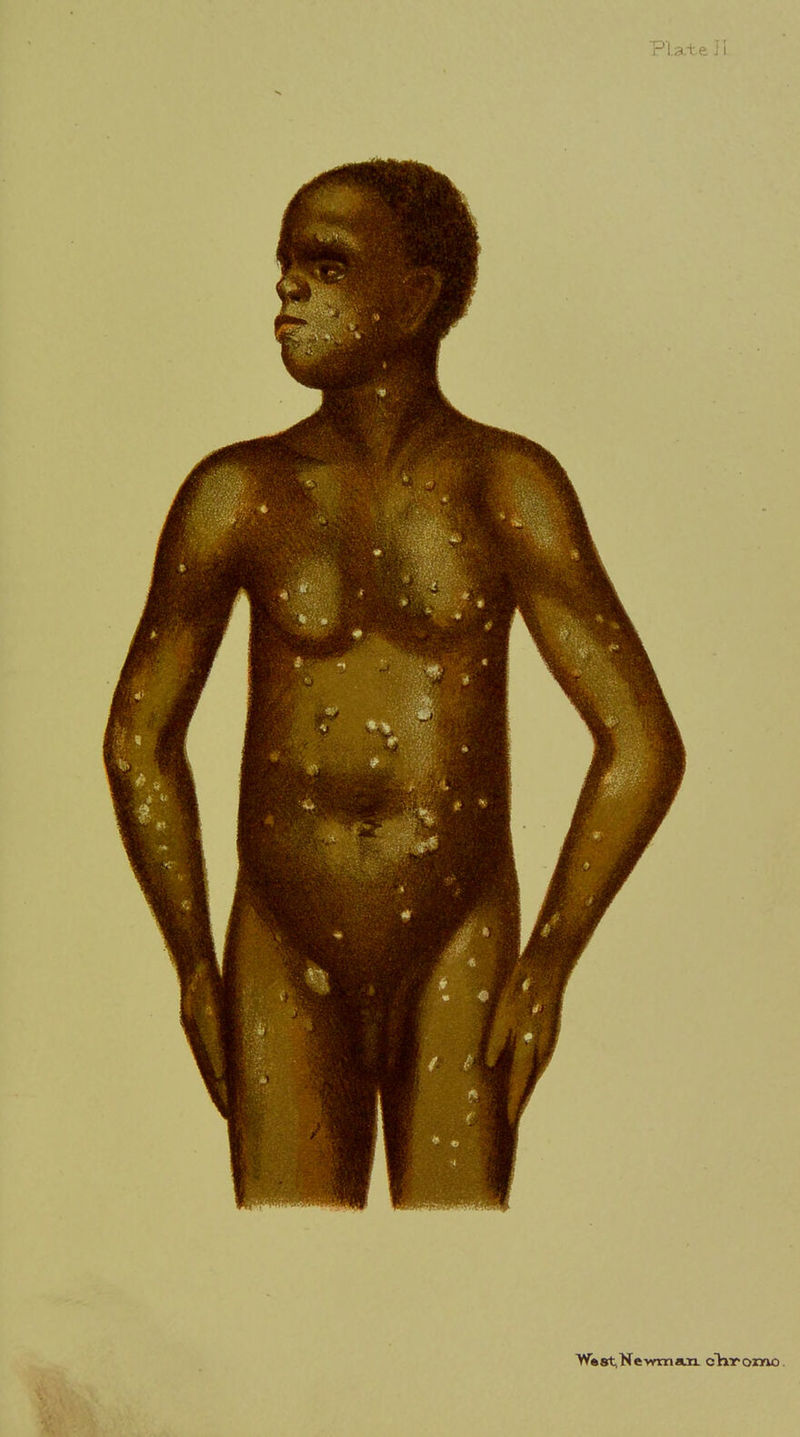 Pla'te li Ws st N e vrm a.n cfh:r omo