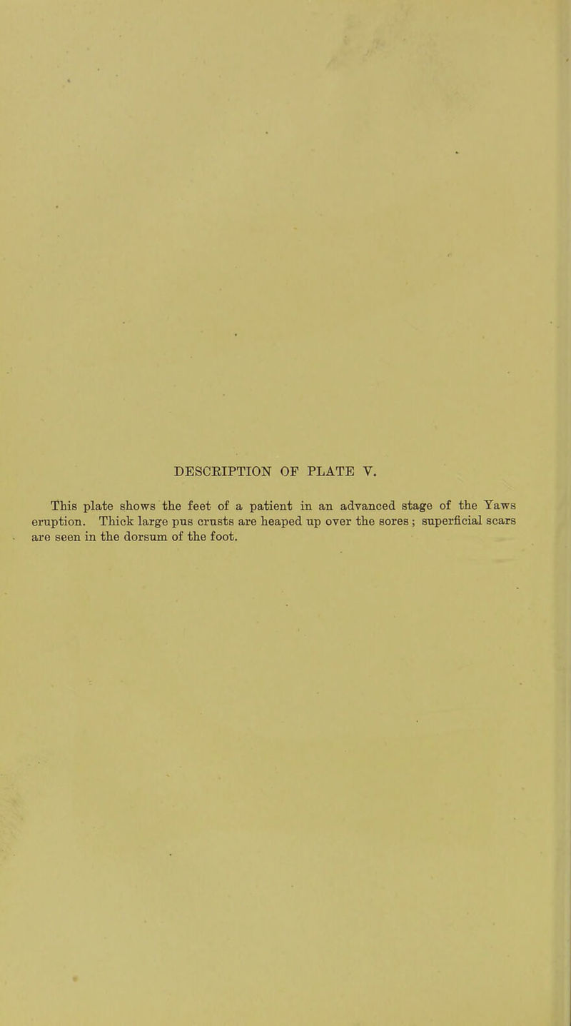 This plate shows the feet of a patient in an advanced stage of the Yaws eruption. Thick large pus crusts are heaped up over the sores; superficial scars are seen in the dorsum of the foot.