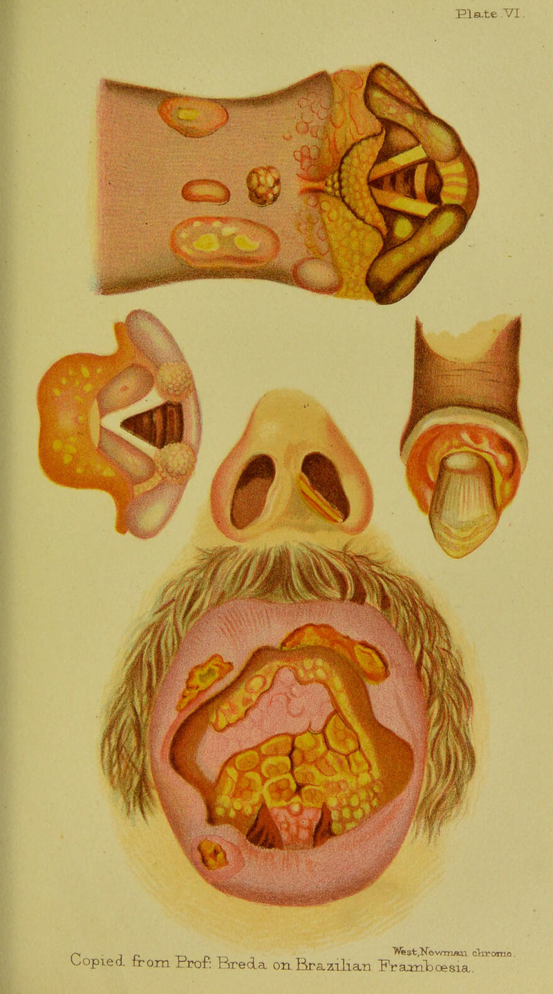 PI a-te .VI. C* ■ i n _ West,Newman ckromo. Copied, from Pror: Precla on Brazilian Prarnboesia.