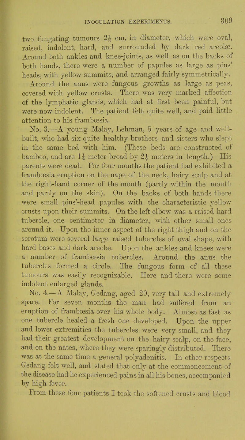 two fungating tumours cm. in diameter, which were oval, raised, indolent, hard, and surrounded by dark red areola?. Around both ankles and knee-joints, as well as on the backs of both hands, there were a number of papules as large as pins’ heads, with yellow summits, and arranged fairly symmetrically. Around the anus were fungous growths as large as peas, covered with yellow crusts. There was very marked affection of the lymphatic glands, which had at first been painful, but were now indolent. The patient felt quite well, and paid little attention to his frambcesia. No. 3.—A young Malay, Lehman, 5 years of age and well- built, who had six quite healthy brothers and sisters who slept in the same bed with him. (These beds are constructed of bamboo, and are 1| meter broad by 2| meters in length.) His parents were dead. For four months the patient had exhibited a frambcesia eruption on the nape of the neck, hairy scalp and at the right-hand corner of the mouth (partly within the mouth and partly on the skin). On the backs of both hands there were small pins’-head papules with the characteristic yellow crusts upon their summits. On the left elbow was a raised hard tubercle, one centimeter in diameter, with other small ones around it. Upon the inner aspect of the right thigh and on the scrotum were several large raised tubercles of oval shape, with hard bases and dark areoke. Upon the ankles and knees were a number of frambcesia tubercles. Around the anus the tubercles formed a circle. The fungous form of all these tumours was easily recognizable. Here and there were some indolent enlarged glands. No. 4.—A Malay, Gedang, aged 20, very tall and extremely spare. For seven months the man had suffered from an eruption of framboesia over his whole body. Almost as fast as one tubercle healed a fresh one developed. Upon the upper and lower extremities the tubercles were very small, and they had their greatest development on the hairy scalp, on the face, and on the nates, where they were sparingly distributed. There was at the same time a general polyadenitis. In other respects Gedang felt well, and stated that only at the commencement of the disease had he experienced pains in all his bones, accompanied by high fever. From these four patients I took the softened crusts and blood