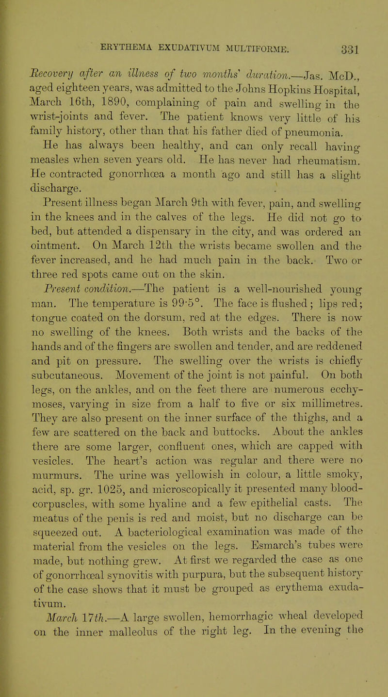 Recovery after an illness of two months' duration. Jas. McD., aged eighteen years, was admitted to the Johns Hopkins Hospital, March 16th, 1890, complaining of pain and swelling in the wrist-joints and fever. The patient knows very little of his family history, other than that his father died of pneumonia. He has always been healthy, and can only recall having- measles when seven years old. He has never had rheumatism. He contracted gonorrhoea a month ago and still has a slight discharge. Present illness began March 9tli with fever, pain, and swelling in the knees and in the calves of the legs. He did not go to bed, but attended a dispensary in the city, and was ordered an ointment. On March 12th the wrists became swollen and the fever increased, and he had much pain in the back. Two or three red spots came out on the skin. Present condition.—The patient is a well-nourished young man. The temperature is 99'5°. The face is flushed ; lips red; tongue coated on the dorsum, red at the edges. There is now no swelling of the knees. Both wrists and the backs of the hands and of the fingers are swollen and tender, and are reddened and pit on pressure. The swelling over the wrists is chiefly subcutaneous. Movement of the joint is not painful. On both legs, on the ankles, and on the feet there are numerous ecchy- moses, varying in size from a half to five or six millimetres. They are also present on the inner surface of the thighs, and a few are scattered on the back and buttocks. About the ankles there are some larger, confluent ones, which are capped with vesicles. The heart’s action was regular and there were no murmurs. The urine was yellowish in colour, a little smoky, acid, sp. gr. 1025, and microscopically it presented many blood- corpuscles, with some hyaline and a few epithelial casts. The meatus of the penis is red and moist, but no discharge can be squeezed out. A bacteriological examination was made of the material from the vesicles on the legs. Esmarch’s tubes were made, but nothing grew. At first we regarded the case as one of gonorrhoeal synovitis with purpura, but the subsequent history of the case shows that it must be grouped as erythema exuda- tivum. March 17th.—A large swollen, hemorrhagic wheal developed on the inner malleolus of the right leg. In the evening the