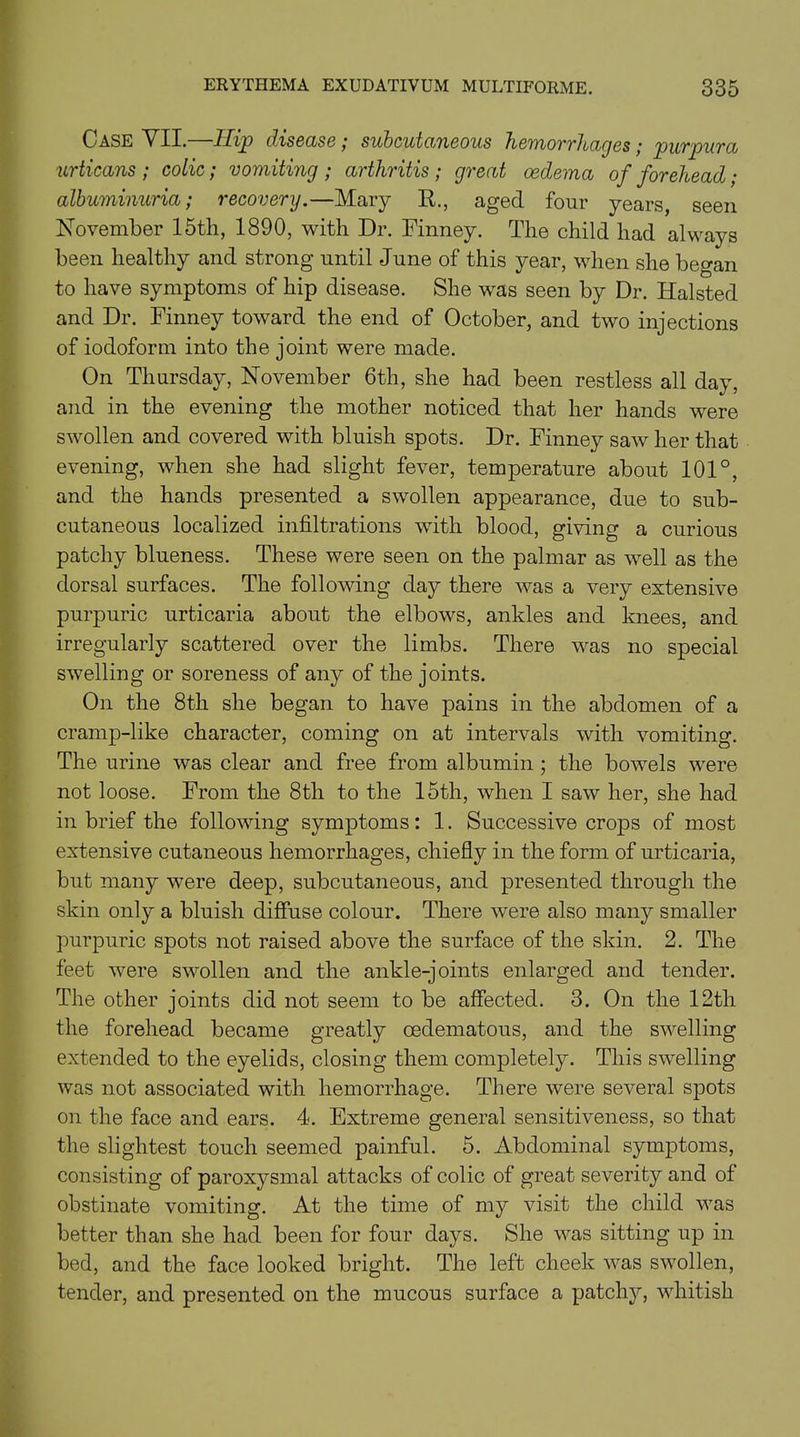 Oase V XX. Hip das ease ; subcutaneous hemorrltages ; purpura urticans ; colic; vomiting ; arthritis; great oedema of forehead; albuminuria; recovery.—Mary R., aged four years, seen November 15th, 1890, with Dr. Finney. The child had always been healthy and strong until June of this year, when she began to have symptoms of hip disease. She was seen by Dr. Halsted and Dr. Finney toward the end of October, and two injections of iodoform into the joint were made. On Thursday, November 6th, she had been restless all day, and in the evening the mother noticed that her hands were swollen and covered with bluish spots. Dr. Finney saw her that evening, when she had slight fever, temperature about 101°, and the hands presented a swollen appearance, due to sub- cutaneous localized infiltrations with blood, giving a curious patchy blueness. These were seen on the palmar as well as the dorsal surfaces. The following day there was a very extensive purpuric urticaria about the elbows, ankles and knees, and irregularly scattered over the limbs. There was no special swelling or soreness of any of the joints. On the 8th she began to have pains in the abdomen of a cramp-like character, coming on at intervals with vomiting. The urine was clear and free from albumin ; the bowels were not loose. From the 8th to the 15th, when I saw her, she had in brief the following symptoms: 1. Successive crops of most extensive cutaneous hemorrhages, chiefly in the form of urticaria, but many were deep, subcutaneous, and presented through the skin only a bluish diffuse colour. There were also many smaller purpuric spots not raised above the surface of the skin. 2. The feet were swollen and the ankle-joints enlarged and tender. The other joints did not seem to be affected. 3. On the 12th the forehead became greatly cedematous, and the swelling extended to the eyelids, closing them completely. This swelling was not associated with hemorrhage. There were several spots on the face and ears. 4. Extreme general sensitiveness, so that the slightest touch seemed painful. 5. Abdominal symptoms, consisting of paroxysmal attacks of colic of great severity and of obstinate vomiting. At the time of my visit the child was better than she had been for four days. She was sitting up in bed, and the face looked bright. The left cheek was swollen, tender, and presented on the mucous surface a patchy, whitish