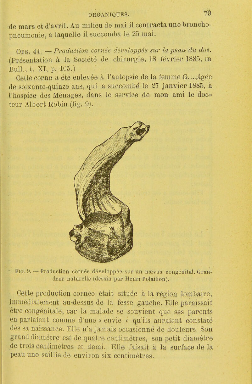 de mars et d'avril. Au milieu de mai il contracta une broncho- pneumonie, à laquelle il succomba le 25 mai. Obs. 44. —Production cornée développée sur la peau du dos. (Présentation à la Société de chirurgie, 18 février 1885, in Bull., t. XI, p. 105.) Cette corne a été enlevée à l'autopsie de la femme G-...,âgée de soixante-quinze ans, qui a succombé le 27 janvier 1885, à l'hospice des Ménages, dans le service de mon ami le doc- teur Albert Robin (fîg. 9). ■ Fi6.9. — Production cbroée développée sur un debylis congénital. Gran- deur naturelle (dessin par Henri Polaillon). Cette production cornée était située à la région lombaire, immédiatement au-dessus de la fesse gauche. Elle paraissait être congénitale, car la malade se souvient que ses parents en parlaient comme d'une « envie » qu'ils auraient constaté dés sa naissance. Elle n'a jamais occasionné de douleurs. Son grand diamètre est de quatre centimètres, son petit diamètre de trois centimètres et demi. Elle faisait à la surface de la peau une saillie de environ six centimètres.