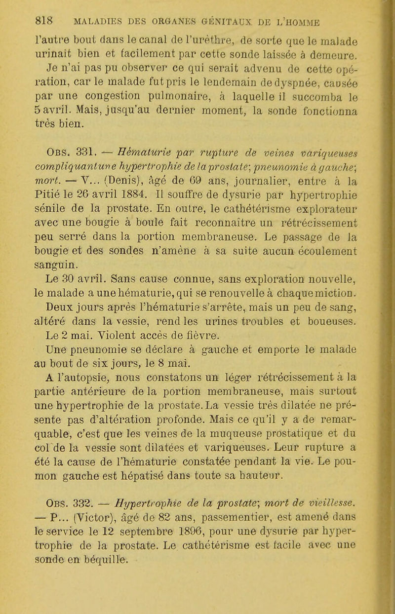 l'autre bout dans le canal de l'urèthre, de sorte que le malade urinait bien et facilement par cette sonde laissée à demeure. Je n'ai pas pu observer ce qui serait advenu de cette opé- ration, car le malade fut pris le lendemain de dyspnée, causée par une congestion pulmonaire, à laquelle il succomba le 5 avril. Mais, jusqu'au dernier moment, la sonde fonctionna très bien. Obs. 331. — Hématurie par rupture d& veines variqueuses compUquanlune hypertrophie de la prostate; pneunomie à gauche; mort. — V... (Denis), âgé de 69 ans, journalier, entre à la Pitié le 26 avril 1884. Il souffre de dysurie par hypertrophie sénile de la prostate. Eu outre, le cathétérisme explorateur avec une bougie à boule fait reconnaître un rétrécissement peu serré dans la portion membraneuse. Le passage de la bougie et des sondes n'amène à sa suite aucun écoulement sanguin. Le 30 avril. Sans cause connue, sans exploration nouvelle, le malade a une hématurie, qui se renouvelle à chaque miction. Deux jours après l'hématurie s'arrête, mais un peu de sang, altéré dans la vessie, rend les urines troubles et boueuses. Le 2 mai. Violent accès de fièvre. Une pneunomie se déclare à gauche et emporte le malade au bout de six jours, le 8 mai. A l'autopsie, nous constatons un léger rétrécissement à la partie antérieure de la portion membraneuse, mais surtout une hypertrophie de la prostate. La vessie très dilatée ne pré- sente pas d'altération profonde. Mais ce qu'il y a de remar- quable, c'est que les veines de la muqueuse prostatique et du col de la vessie sont dilatées et variqueuses. Leur rupture a été la cause de l'hématurie constatée pendant la vie. Le pou- mon gauche est hépatisé dans toute sa bauteur. Obs. 332. — Hypertrophie de la prostate; mort de vieillesse. — P... (Victor), âgé de 82 ans, passementier, est amené dans le service le 12 septembre 1896, pour une dysurie par hyper- trophie de la prostate. Le cathétérisme est facile avec une sonde en béquille.