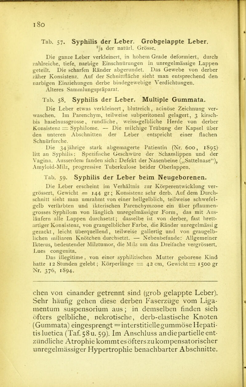 i8o Tab. 57. Syphilis der Leber. Grobgelappte Leber. ^'/s der natürl. Grösse. Die ganze Leber verkleinert, in hohem Grade deformiert, durch zahlreiche, tiefe, narbige Einschnürungen in unregelmässige Läppert geteilt. Die scharfen Ränder abgerundet. Das Gewebe von derber zäher Konsistenz. Auf der Schnittfläche sieht man entsprechend den narbigen Einziehungen derbe bindegewebige Verdichtungen, Älteres Sammlungspräparat. Tab. 58, Syphilis der Leber. Multiple Gummata. Die Leber etwas verkleinert, blutreich, acinöse Zeichnung ver- waschen. Im Parenchym, teilweise subperitoneal gelagert, 3 kirsch- bis haselnussgrosse, rundliche, weiss-gelbliche Herde von derber Konsistenz — Syphilome. — Die milchige Trübung der Kapsel über den unteren Abschnitten der Leber entspricht einer flachen Schnürfurche. Die 34jährige stark abgemagerte Patientin (Nr. 600, 1895) litt an Syphilis: Spezifische Geschwüre der Schamlippen und der Vagina. Ausserdem fanden sich: Defekt der Nasenbeine (,,Sattelnase),. Amyloid-Milz, progressive Tuberkulose beider Oberlappen. Tab. 59. Syphilis der Leber beim Neugeborenen. Die Leber erscheint im Verhältnis zur Körperentwicklung ver- grössert, Gewicht = 144 gr; Konsistenz sehr derb. Auf dem Durch- schnitt sieht man umrahmt von einer hellgelblich, teilweise schwefel- gelb verfärbten und ikterischen Parenchymzone ein über pflaumen- grosses Syphilom von länglich unregelmässiger Form, das mit Aus- läufern alle Lappen durchsetzt; dasselbe ist von derber, fast brett- artiger Konsistenz, von graugelblicher Farbe, die Ränder unregelmässig gezackt, leicht überquellend, teilweise gallertig und von graugelb- lichen miliaren Knötchen durchsetzt. — Nebenbefunde: Allgemeiner Ikterus, bedeutender JMilztumor, die Milz um das Dreifache vergrössert. Lues congenita. Das illegitime , von einer syphilitischen Mutter geborene Kind hatte 12 Stunden gelebt; Körperlänge = 42 cm, Gewicht z=i 1500 gr Nr. 376, 1894. chen von einander getrennt sind (^rob gelappte Leber). Sehr häufig gehen diese derben Faserzüge vom Liga- mentum Suspensorium aus ; in demselben finden sieb öfters gelbliche, nekrotische, derb-elastische Knoten (Gutnmata) eingesprengt = interstitielle gummöse Hepati- tis luetica (Taf. 58U. 59). Im Anschluss andiepartielleent- zündliche Atrophie kommt es öfters zu kompensatorischer unregelmässiger Hypertrophie benachbarter Abschnitte.