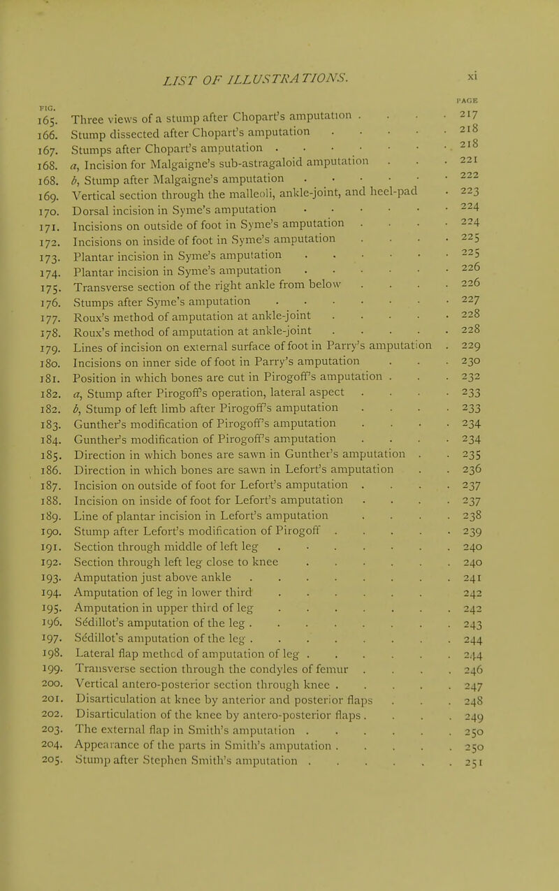 FIG. 165. Three views of a stump after Chopart's amputation . 166. Stump dissected after Chopart's amputation .... 167. Stumps after Chopart's amputation . . • • 168. a, Incision for Malgaigne's sub-astragaloid amputation 168. Stump after Malgaigne's amputation 169. Vertical section through the malleoli, ankle-joint, and heel-pad 170. Dorsal incision in Syme's amputation 171. Incisions on outside of foot in Syme's amputation . 172. Incisions on inside of foot in Syme's amputation 173. Plantar incision in Syme's amputation 174. Plantar incision in Syme's amputation 175. Transverse section of the right ankle from below ] 76. Stumps after Syme's amputation 177. Roux's method of amputation at ankle-joint .... 178. Roux's method of amputation at ankle-joint .... 179. Lines of incision on external surface of foot in Parry's amputation 180. Incisions on inner side of foot in Parry's amputation 181. Position in which bones are cut in Pirogoff's amputation . 182. a. Stump after Pirogoffs operation, lateral aspect 182. ^, Stump of left limb after Pirogoff's amputation 183. Gunther's modification of Pirogoff's amputation 184. Gunther's modification of Pirogoff's amputation 185. Direction in which bones are sawn in Gunther's amputation . 186. Direction in which bones are sawn in Lefort's amputation 187. Incision on outside of foot for Lefort's amputation . 188. Incision on inside of foot for Lefort's amputation 189. Line of plantar incision in Lefort's amputation 190. Stump after Lefort's modification of Pirogoff .... 191. Section through middle of left leg ...... 192. Section through left leg close to knee ..... 193. Amputation just above ankle 194. Amputation of leg in lower third ...... 195. Amputation in upper third of leg ...... 196. S^dillot's amputation of the leg 197. Sedillot's amputation of the leg 198. Lateral flap method of amputation of leg ..... 199. Transverse section through the condyles of femur . 200. Vertical antero-posterior section through knee .... 201. Disarticulation at knee by anterior and posterior flaps 202. Disarticulation of the knee by antero-posterior flaps . 203. The external flap in Smith's amputation 204. Appearance of the parts in Smith's amputation .... 205. Stump after Stephen Smith's amputation