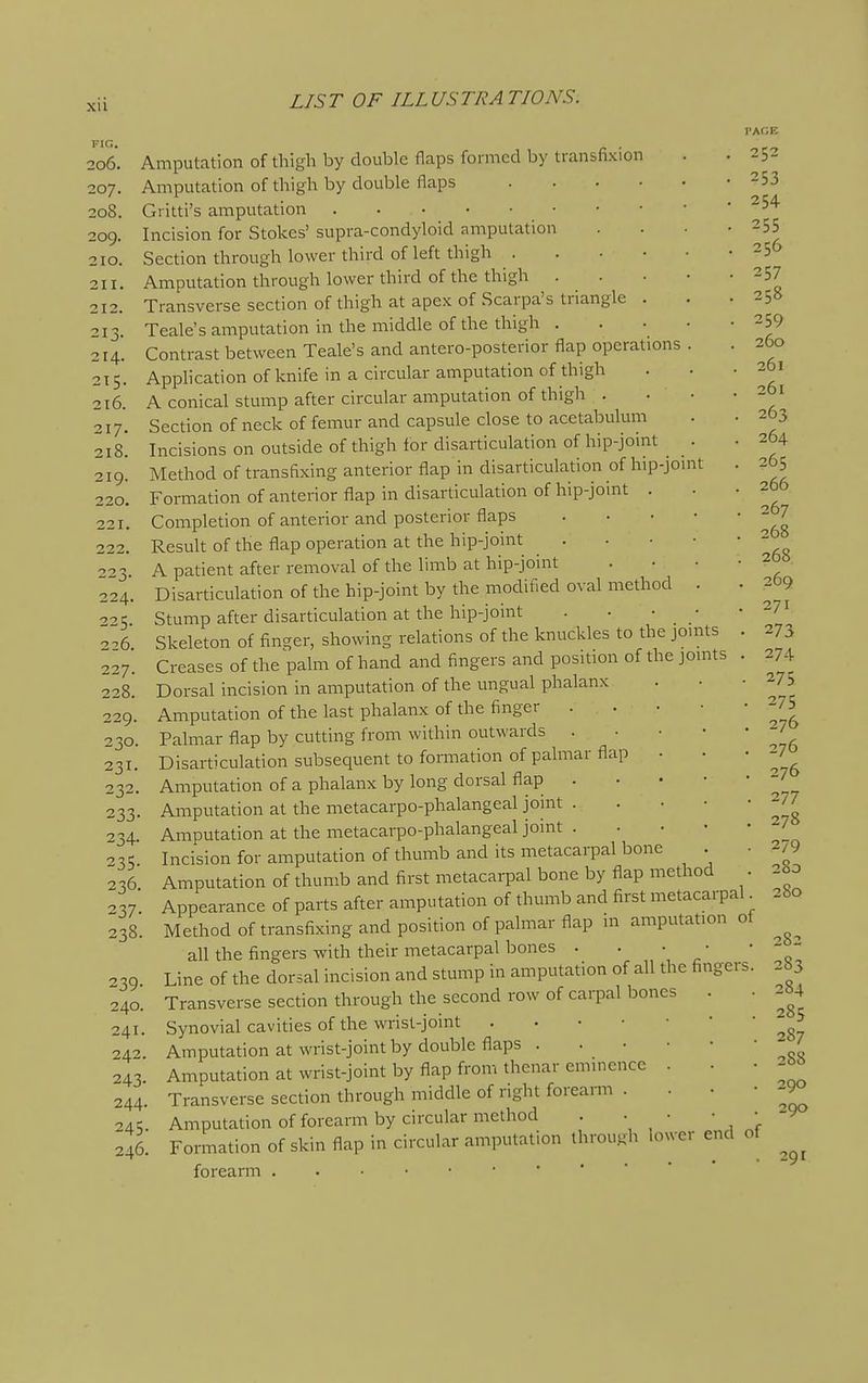 Xll FIG. LIST OF ILLUSTRATIONS. ;o6. Amputation of thigh by double flaps formed by transfixion . .252 207. Amputation of thigh by double flaps -53 208. Gritti's amputation ' 209. Incision for Stokes' supra-condyloid amputation .... 255 Section through lower third of left thigh 256 210. 211. Amputation through lower third of the thigh . . . • • 257 Transverse section of thigh at apex of Scarpa's triangle . . .258 212. 21 214. Contrast between Teale's and antero-posterior flap operations 215. Apphcation of knife in a circular amputation of thigh - • .261 <. Teale's amputation in the middle of the thigh . . • • -259 _ , . rT-._-i_) 1 „«^-,:>^,^_r^ncfo1-;r>r flan nnprations . . 2DO 261 216. A^conical Stump after circular amputation of thigh . • • -261 Section of neck of femur and capsule close to acetabulum . • 263 Incisions on outside of thigh for disarticulation of hip-joint . • 264 219. Method of transfixing anterior flap in disarticulation of hip-jomt . 265 220. Formation of anterior flap in disarticulation of hip-jomt - • -266 217 218 ■J.ZI. Completion of anterior and posterior flaps 2 7 222. Result of the flap operation at the hip-joint 2 003 A patient after removal of the limb at hip-joint . • • • 2 224. Disarticulation of the hip-joint by the modified oval method . • 2O9 o^c Stump after disarticulation at the hip-joint . • • • .271 Ze Skeleton of finger, showing relations of the knuckles to the jomts . 273 227. Creases of the palm of hand and fingers and position of the jomts . 274 228. Dorsal incision in amputation of the ungual phalanx . • -275 229. Amputation of the last phalanx of the finger 275 230. Palmar flap by cutting from within outwards J 231. Disarticulation subsequent to formation of palmar flap ... -7 232. Amputation of a phalanx by long dorsal flap . 233. Amputation at the metacarpo-phalangeal johit . . 234. Amputation at the metacarpo-phalangeal joint . • ' ' ' 235 Incision for amputation of thumb and its metacarpal bone . 2 ^6 Amputation of thumb and first metacarpal bone by flap method 276 277 279 280 280 . 37 Appearance of parts after amputation of thumb and first metacarpal 238. Method of transfixing and position of palmar flap in amputation of all the fingers with their metacarpal bones 2 - 239 Line of the dorsal incision and stump in amputation of all the fingers. 2b3 240. Transverse section through the second row of carpal bones . • 264 t~m •■t *!* J-1-> j-v ^•w^•^-^ f?^_l/~^^tT^ _ ■ • • 287 288 290 290 241. Synovial cavities of the wrist-joint 242 Amputation at wrist-joint by double flaps . 243 Amputation at wrist-joint by flap from thenar emmence 244. Transverse section through middle of right forearm . 24s. Amputation offorearm by circular method . • 246. Formation of skin flap in circular amputation through lower end of forearm 291