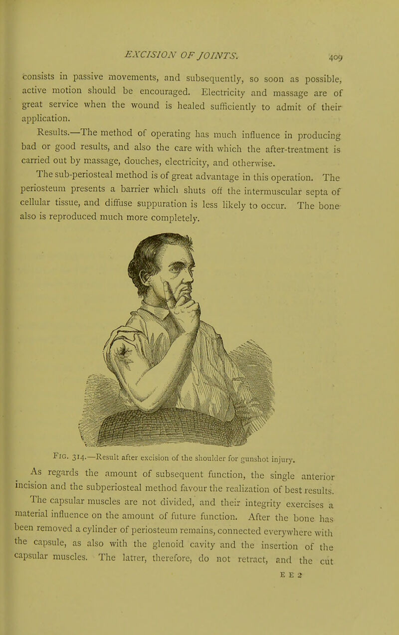 consists in passive movements, and subsequently, so soon as possible, active motion should be encouraged. Electricity and massage are of great service when the wound is healed sufficiently to admit of their application. Results.—The method of operating has much influence in producing bad or good results, and also the care with which the after-treatment is carried out by m.assage, douches, electricity, and otherwise. The sub-periosteal method is of great advantage in this operation. The periosteum presents a barrier which shuts off the intermuscular septa of cellular tissue, and diffuse suppuration is less likely to occur. The bone- also is reproduced much more completely. Fig. 314.—Result after excision of the shoulder for gunshot injury. As regards the amount of subsequent function, the single anterior incision and the subperiosteal method favour the realization of best results. The capsular muscles are not divided, and their integrity exercises a material influence on the amount of future function. After tlie bone has been removed a cylinder of periosteum remains, connected everywhere with the capsule, as also with the glenoid cavity and the insertion of tlie capsular muscles. The latter, therefore, do not retract, and the cut