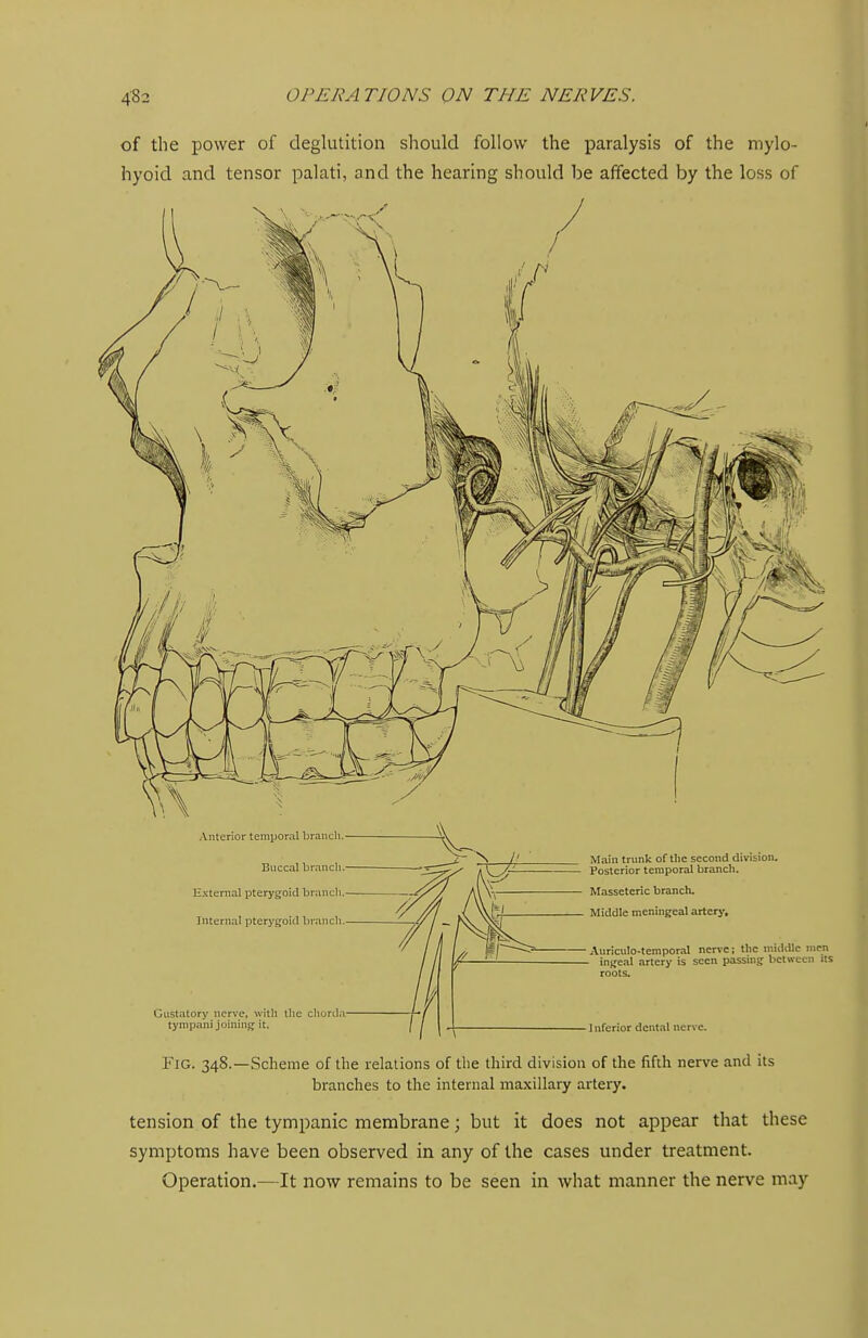of the power of deglutition should follow the paralysis of the mylo- hyoid and tensor palati, and the hearing should be affected by the loss of Anterior temporal brancli. Buccal branch Hxteriial pterygoid brancli Internal pterygoid brancli Gustatory nerve, with the chorda tynipani joining it. Main trunk of the second division. Posterior temporal branch. Masseteric branch. Middle meningeal artery. ,\uricuIo-temporaI nerve; the middle men ingeal artery is seen passing between its roots. Inferior dental nerve. Fig. 348.—Scheme of the relations of the third division of the fifth nerve and its branches to the internal maxillary artery. tension of the tympanic membrane; but it does not appear that these symptoms have been observed in any of the cases under treatment. Operation.—It now remains to be seen in what manner the nerve may