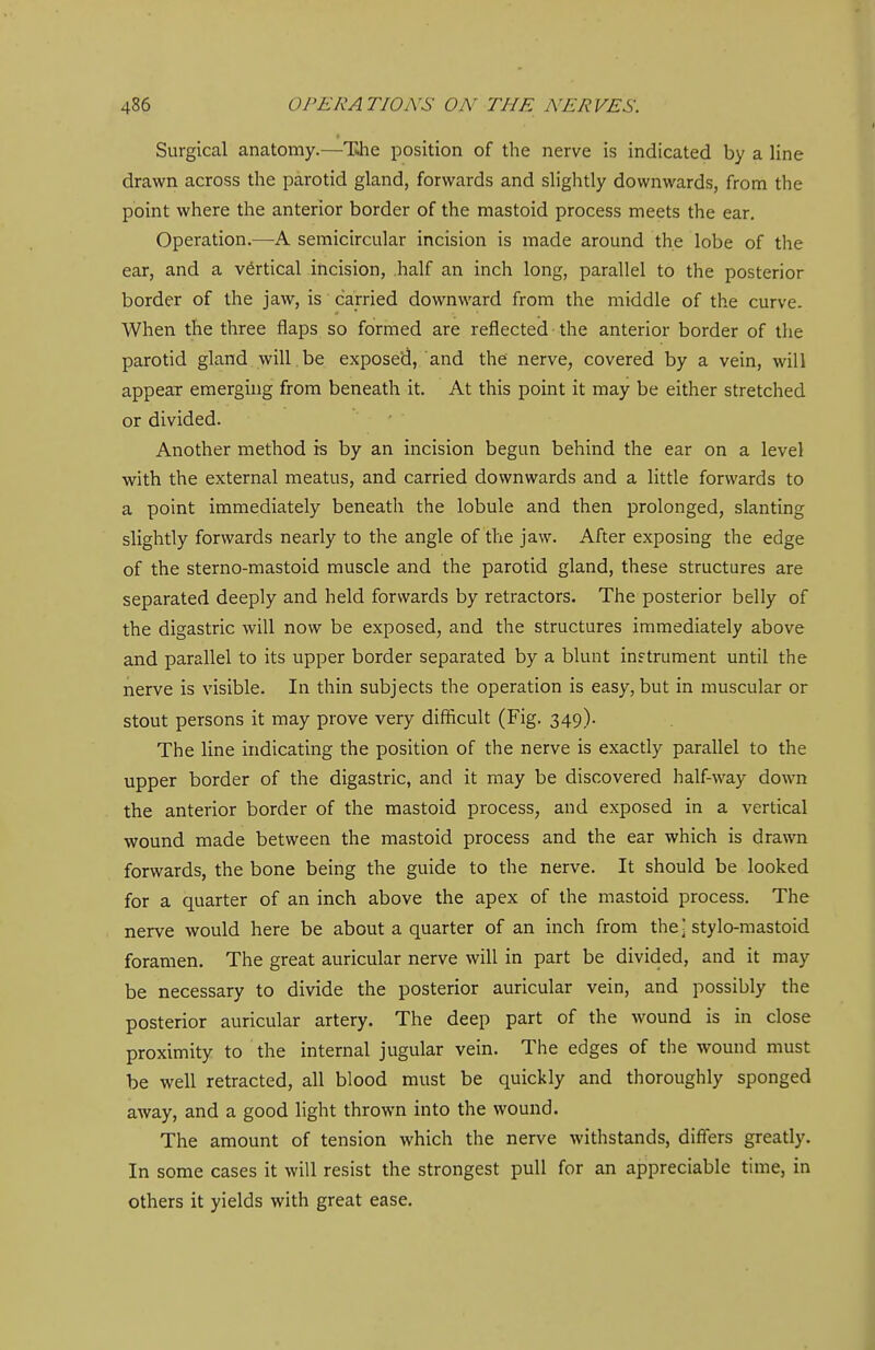 Surgical anatomy.—TJie position of the nerve is indicated by a line drawn across the parotid gland, forwards and slightly downwards, from the point where the anterior border of the mastoid process meets the ear. Operation.—A semicircular incision is made around the lobe of the ear, and a vertical incision, .half an inch long, parallel to the posterior border of the jaw, is carried downward from the middle of the curve. When the three flaps so formed are reflected the anterior border of the parotid gland will be exposed, and the nerve, covered by a vein, will appear emerging from beneath it. At this point it may be either stretched or divided. Another method is by an incision begun behind the ear on a level with the external meatus, and carried downwards and a little forwards to a point immediately beneath the lobule and then prolonged, slanting slightly forwards nearly to the angle of the jaw. After exposing the edge of the sterno-mastoid muscle and the parotid gland, these structures are separated deeply and held forwards by retractors. The posterior belly of the digastric will now be exposed, and the structures immediately above and parallel to its upper border separated by a blunt instrument until the nerve is visible. In thin subjects the operation is easy, but in muscular or stout persons it may prove very difficult (Fig. 349). The line indicating the position of the nerve is exactly parallel to the upper border of the digastric, and it may be discovered half-way down the anterior border of the mastoid process, and exposed in a vertical wound made between the mastoid process and the ear which is drawn forwards, the bone being the guide to the nerve. It should be looked for a quarter of an inch above the apex of the mastoid process. The nerve would here be about a quarter of an inch from the stylo-mastoid foramen. The great auricular nerve will in part be divided, and it may be necessary to divide the posterior auricular vein, and possibly the posterior auricular artery. The deep part of the wound is in close proximity to the internal jugular vein. The edges of the wound must be well retracted, all blood must be quickly and thoroughly sponged away, and a good light thrown into the wound. The amount of tension which the nerve withstands, differs greatly. In some cases it will resist the strongest pull for an appreciable time, in others it yields with great ease.